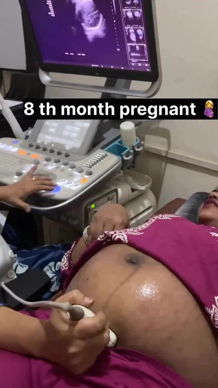 @Alina