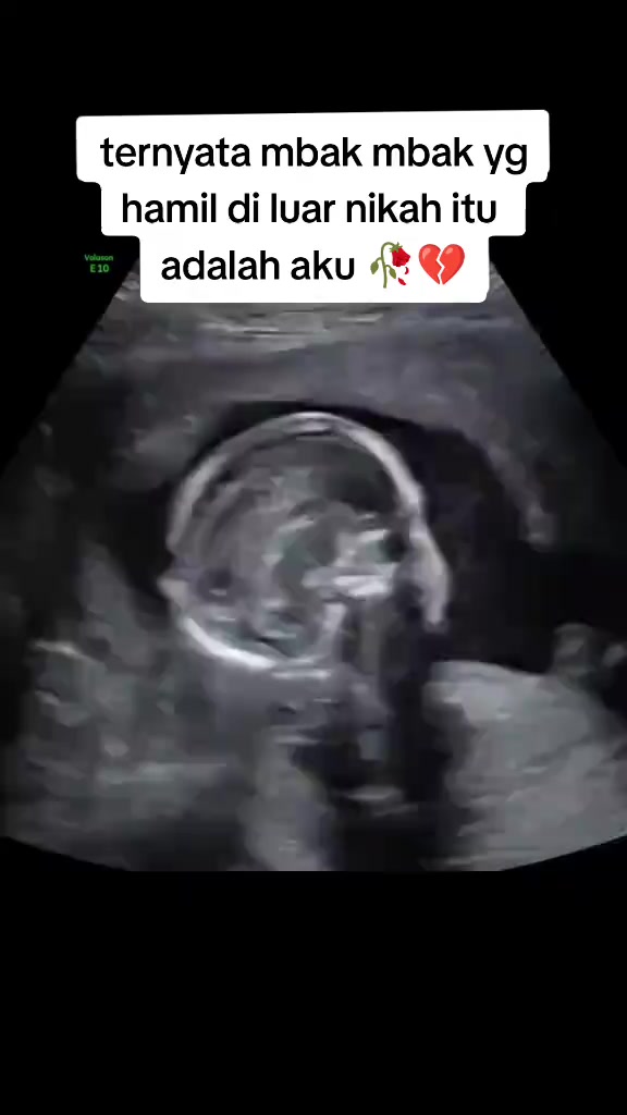@ARISKA PUTRI