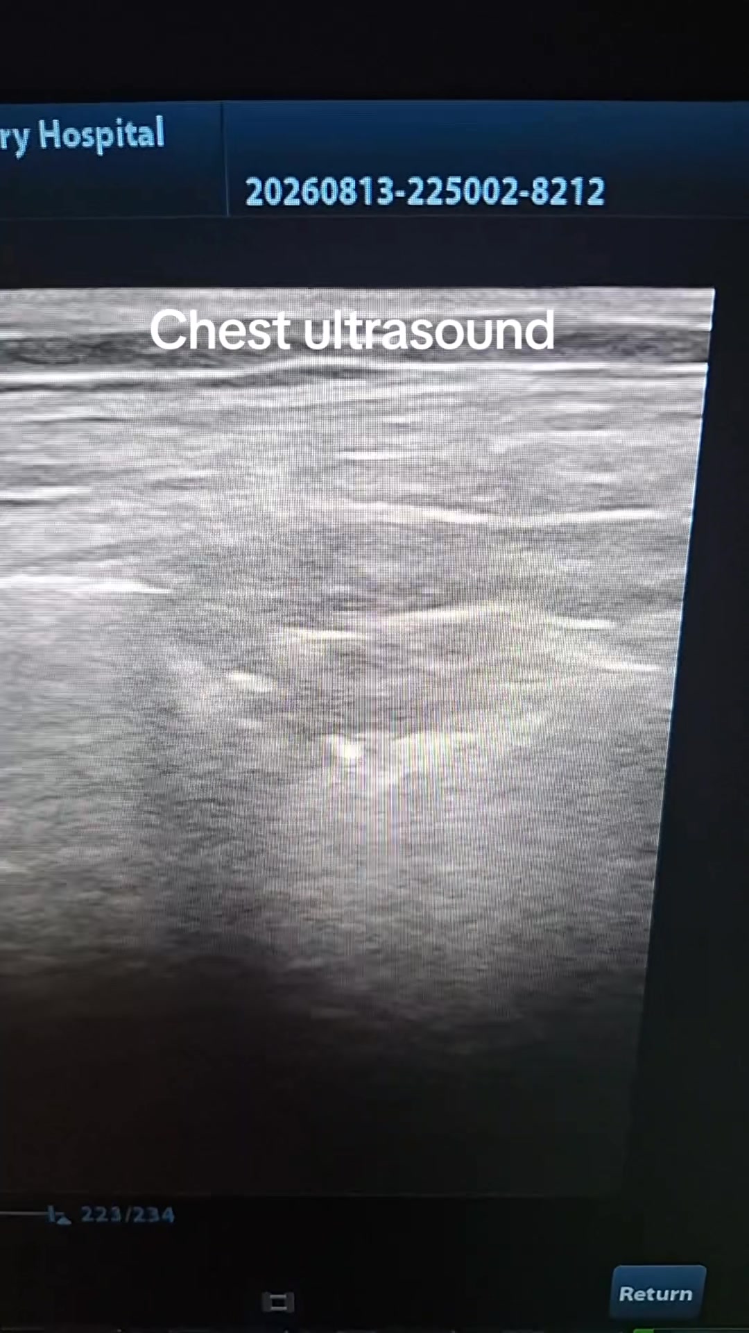 @Dr Wubie Endalew(Radiologist)