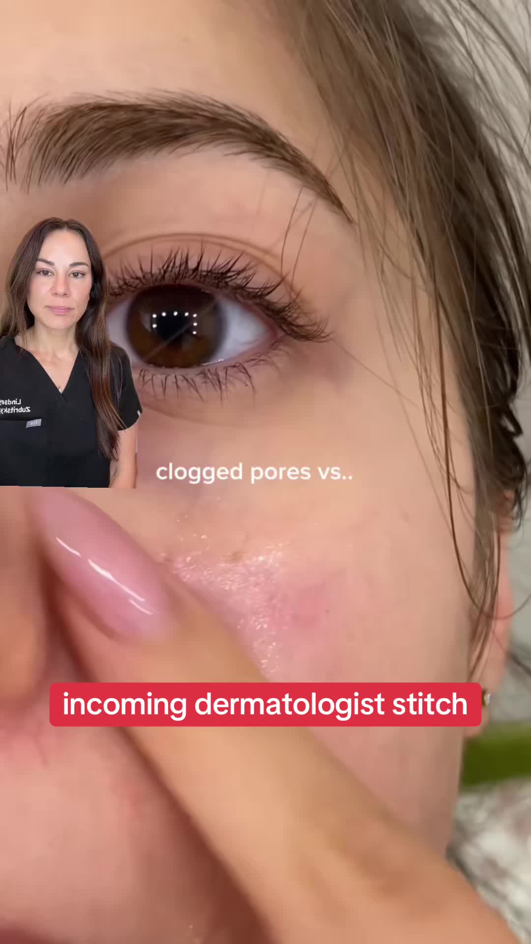 @Dermguru