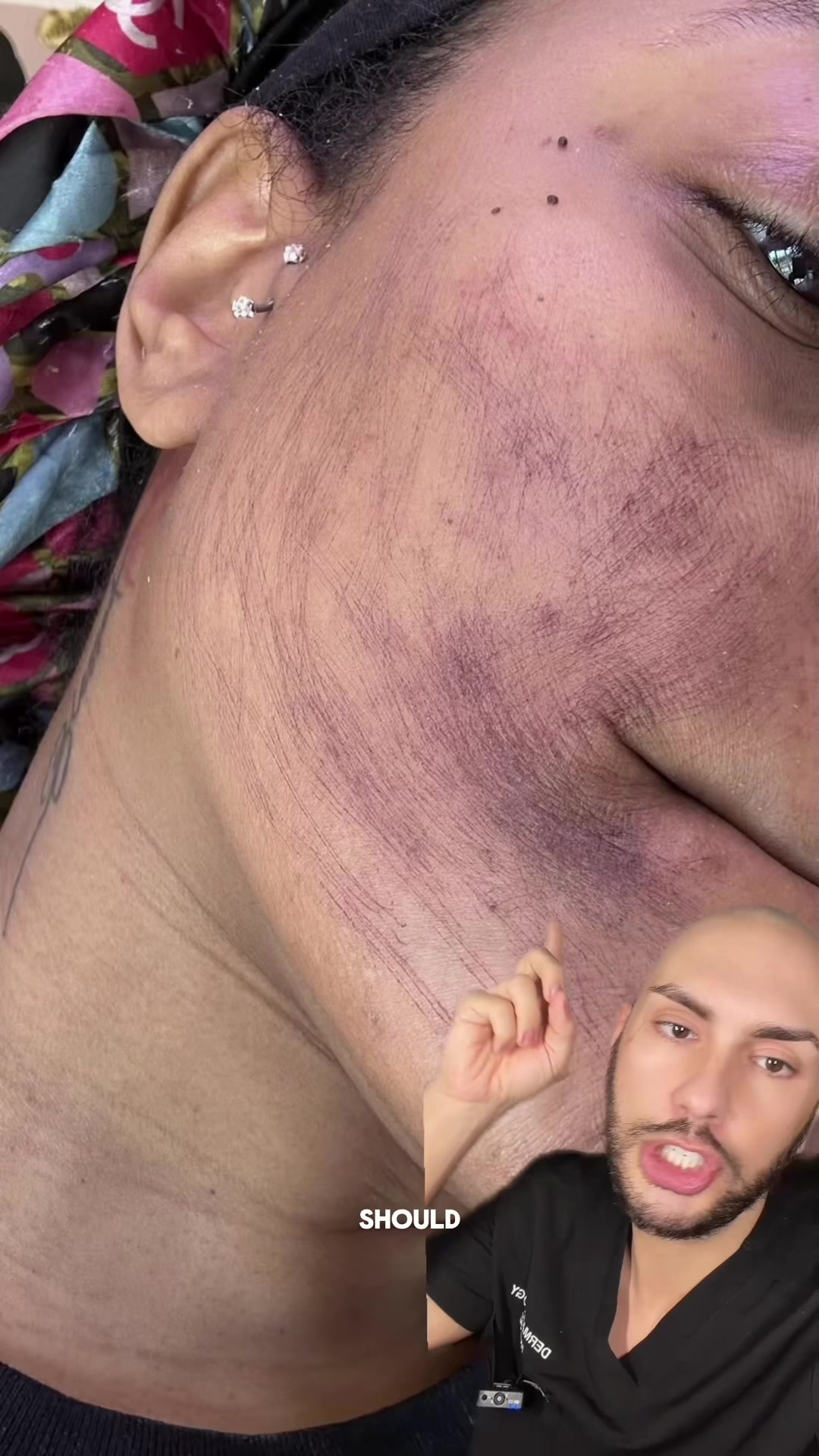 @Justin | Dermatology Nurse🇨🇦