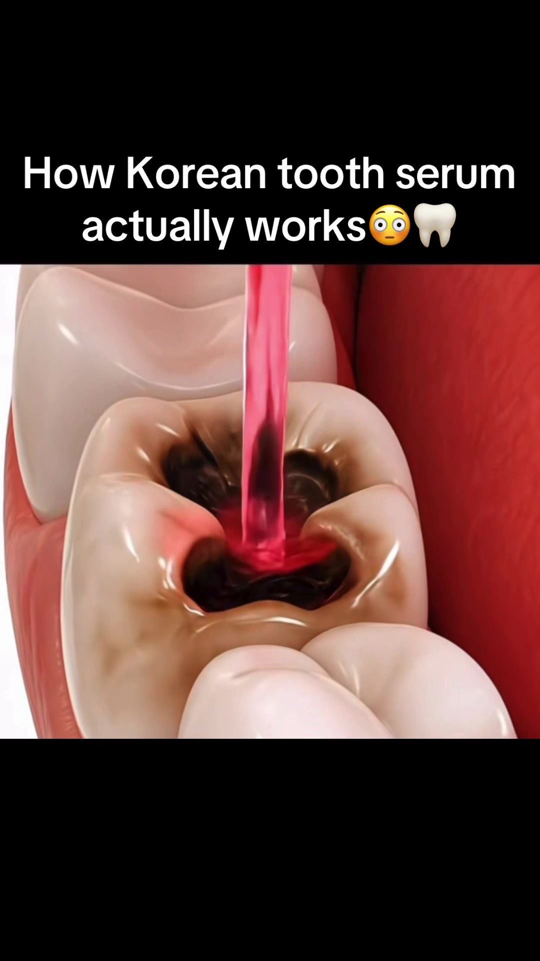 @…