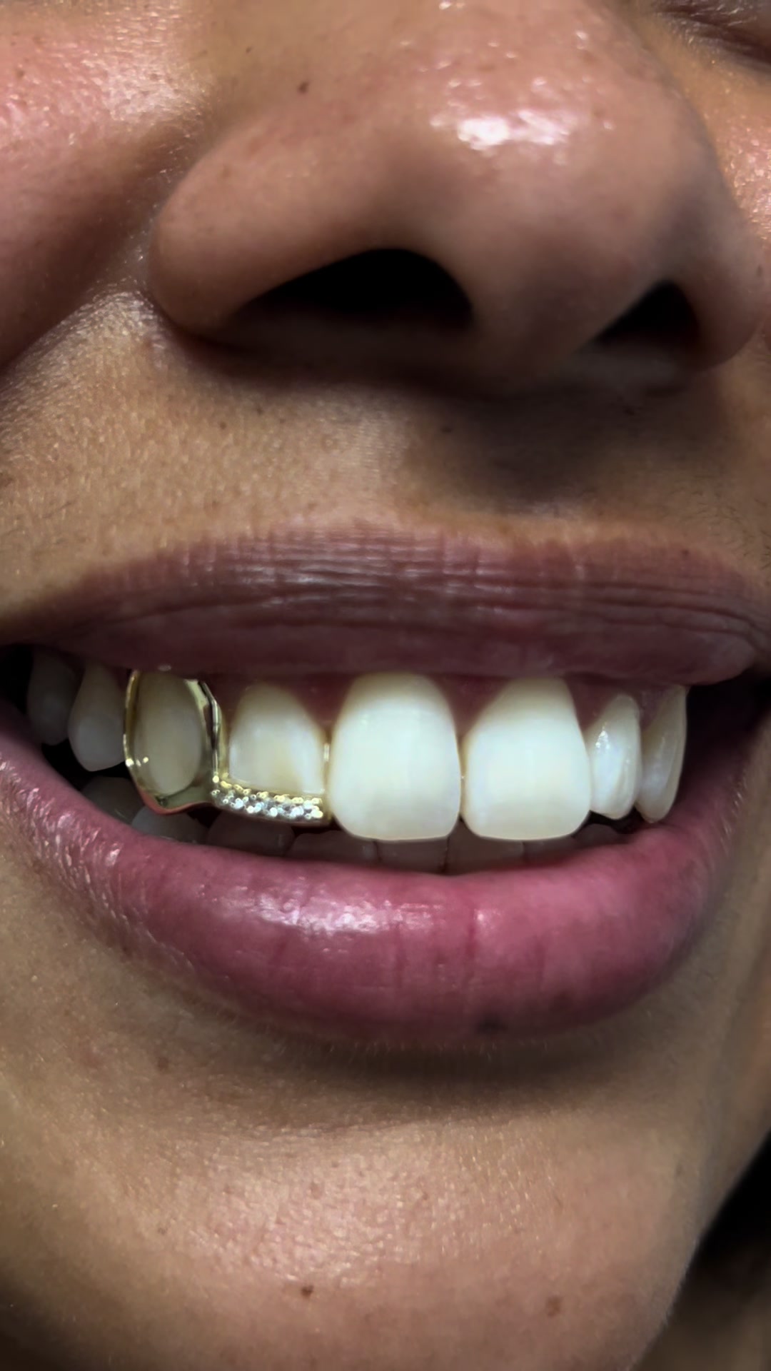 @Grillz & Gold | Bryan