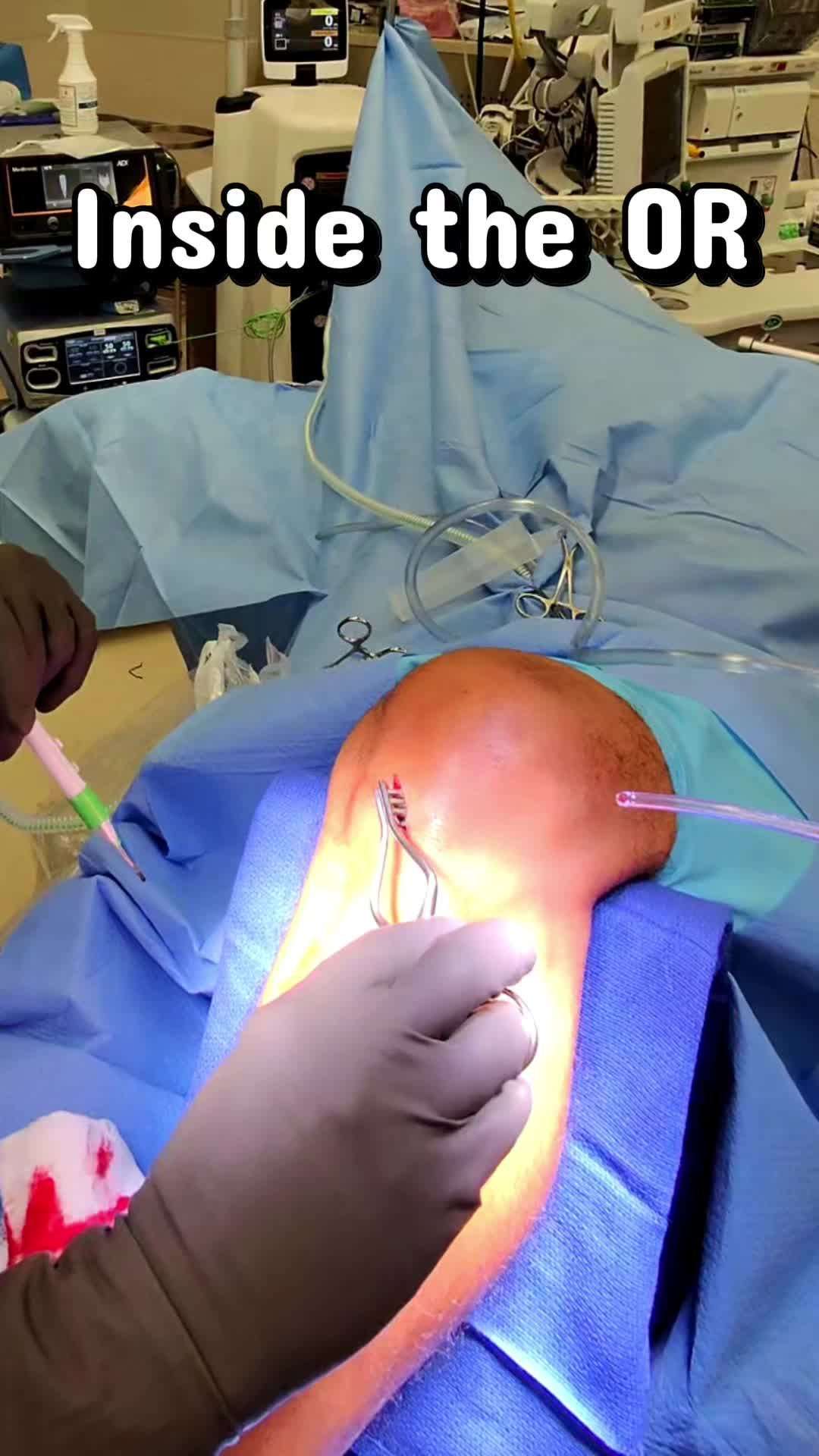 @Ortho POV