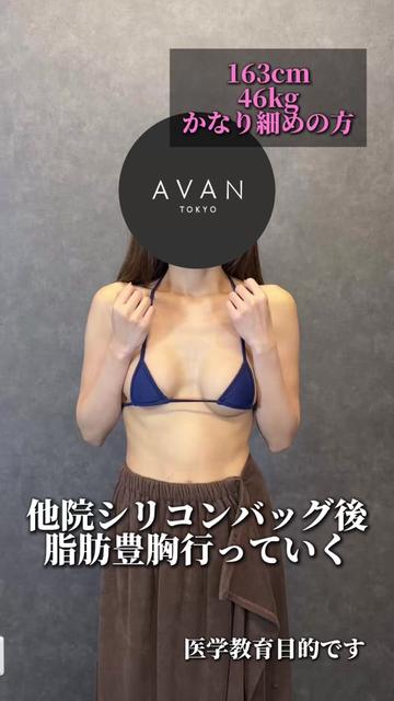 @森脇進/二の腕脂肪吸引・豊胸/AVAN TOKYO