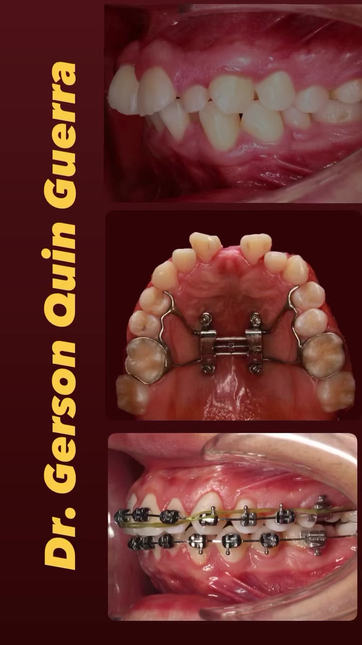 @Dr. Gerson Quin Guerra, PhD