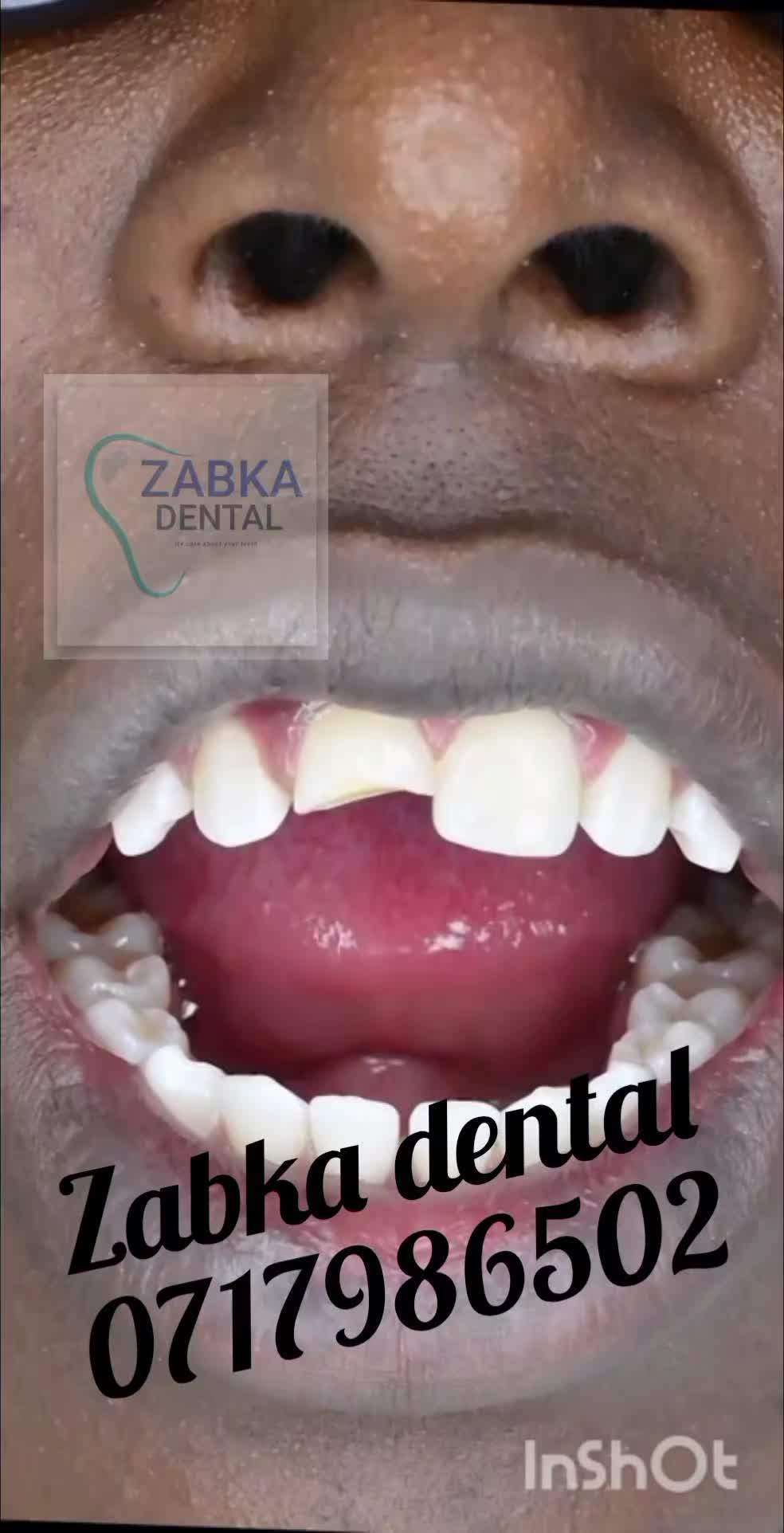 @Zabka Dental