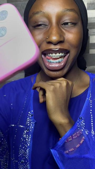 @Braces.bymavi|Smile Aesthetics