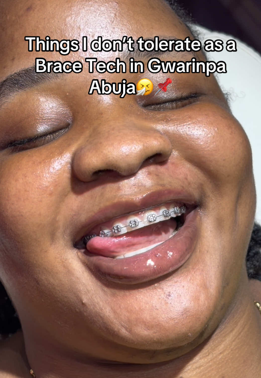 @Abuja Fashion Braces/Toothgems