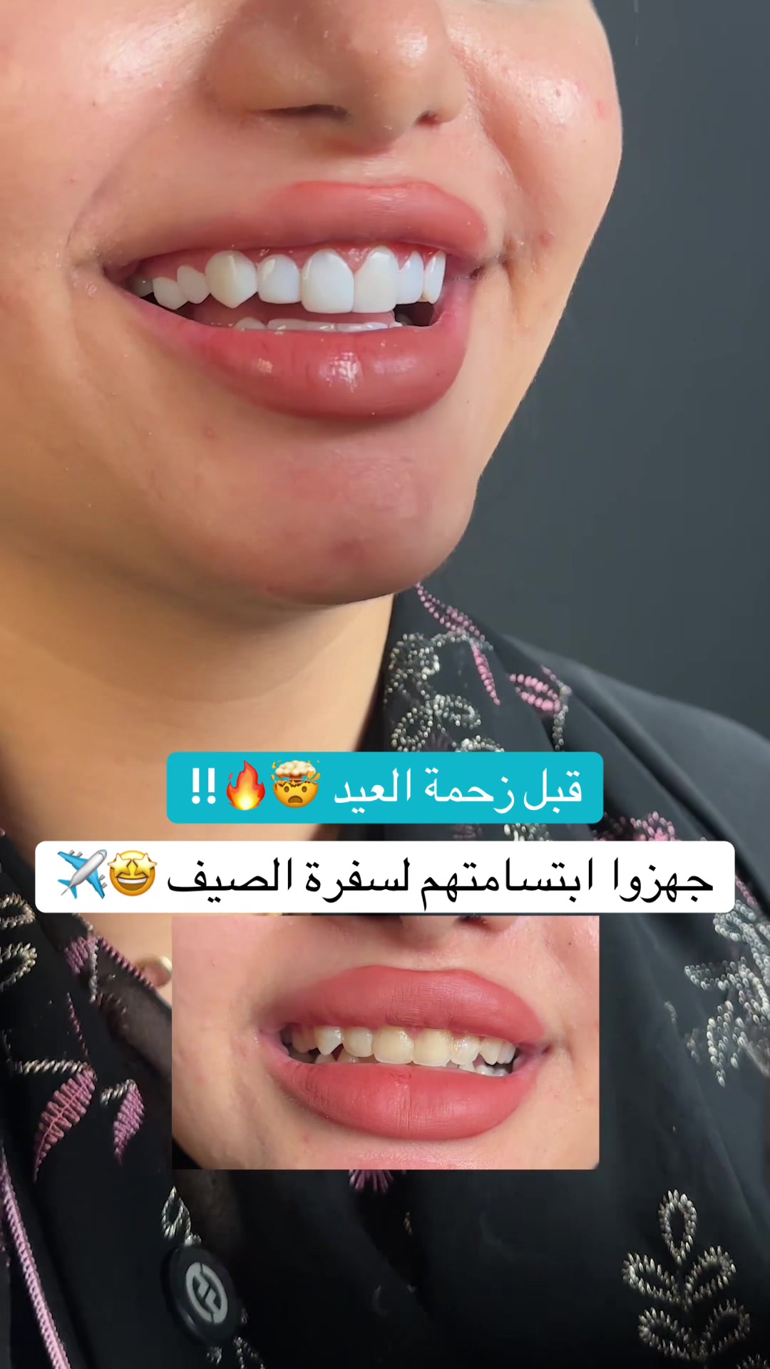 @Dr.lina_almasmoum