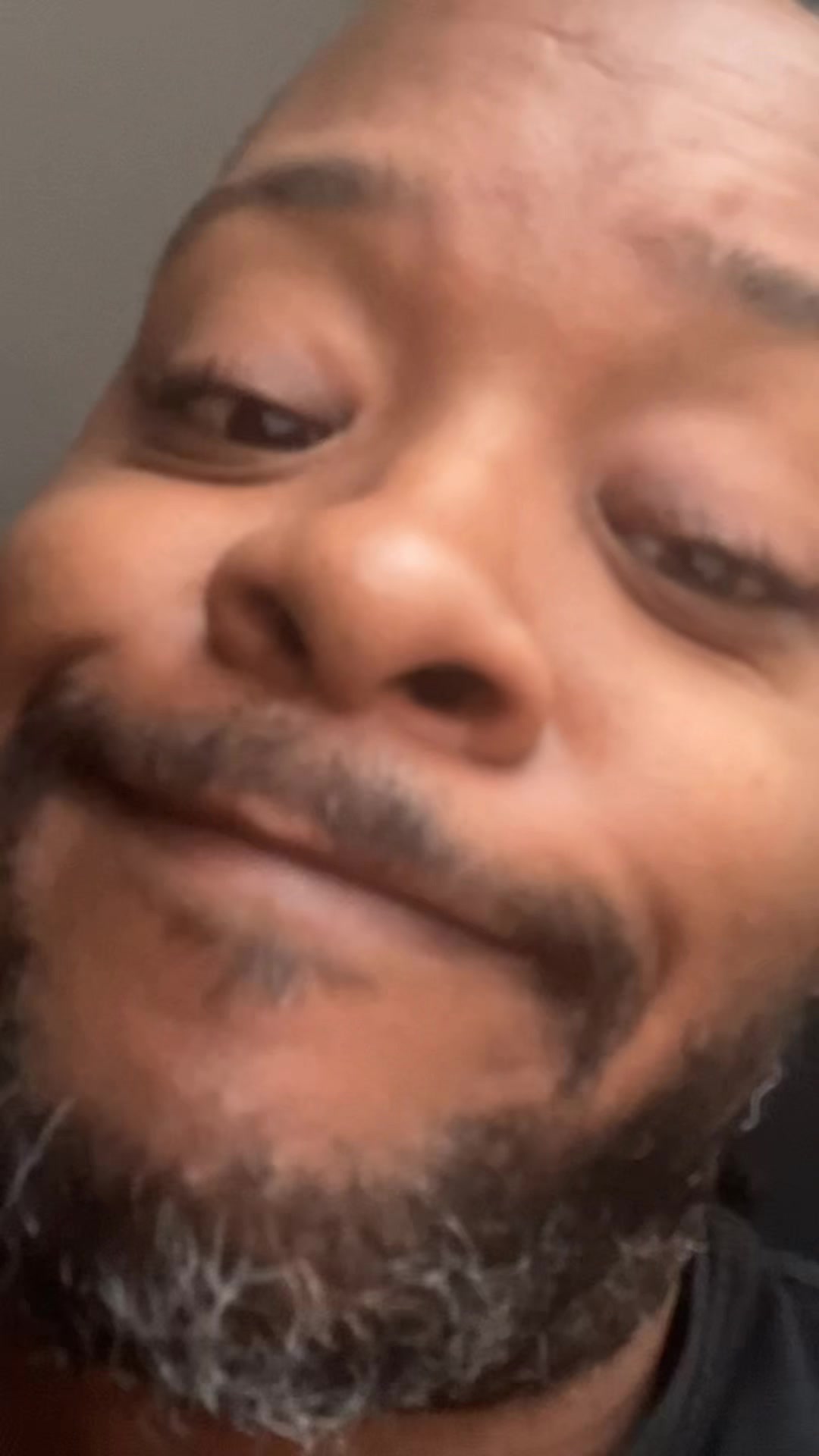 @Skalla Vision