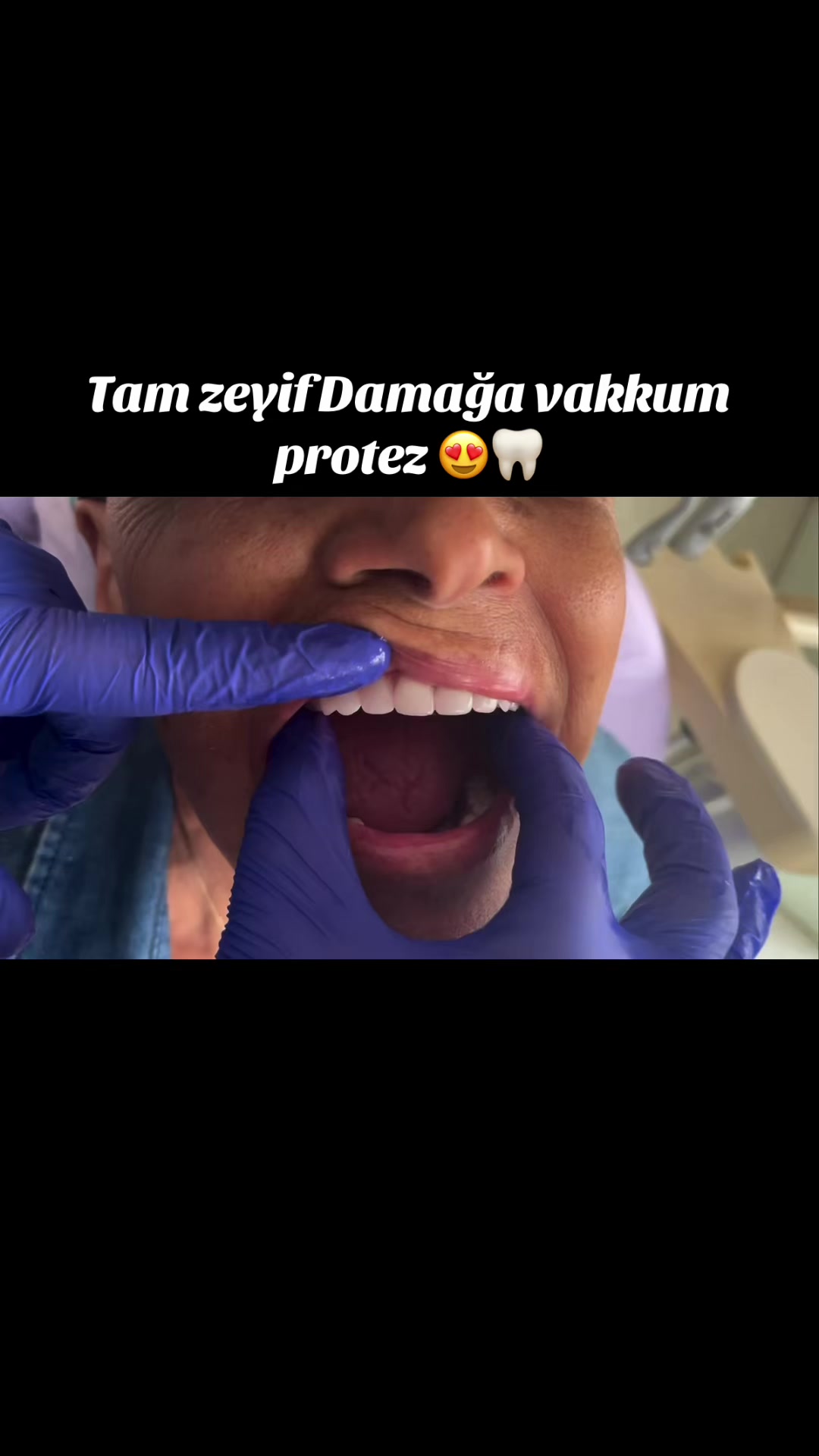 @𝐁𝐚𝐲𝐃𝐞𝐧𝐭𝐄𝐥𝐢𝐭𝐞 🦷