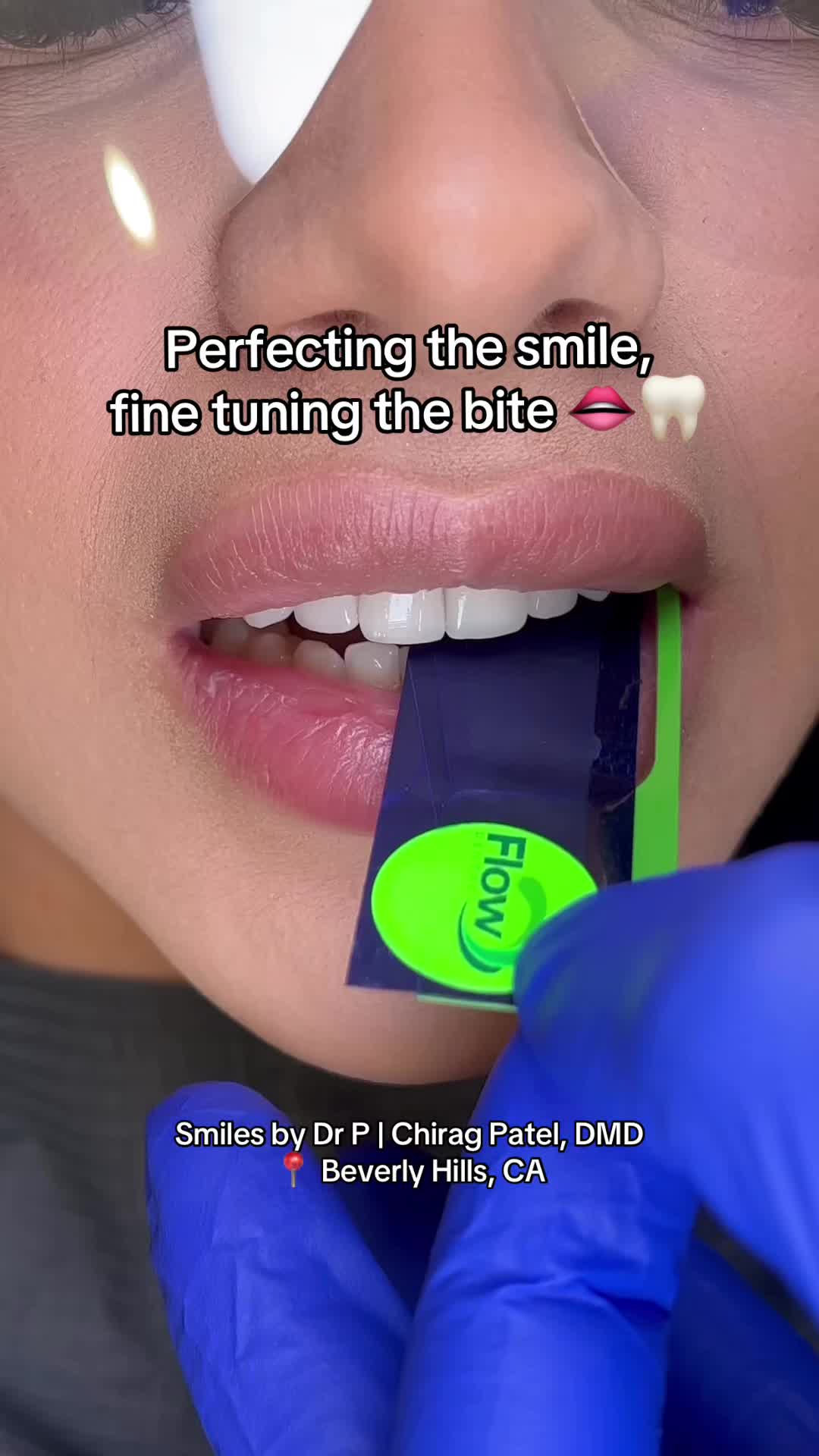 @Veneers