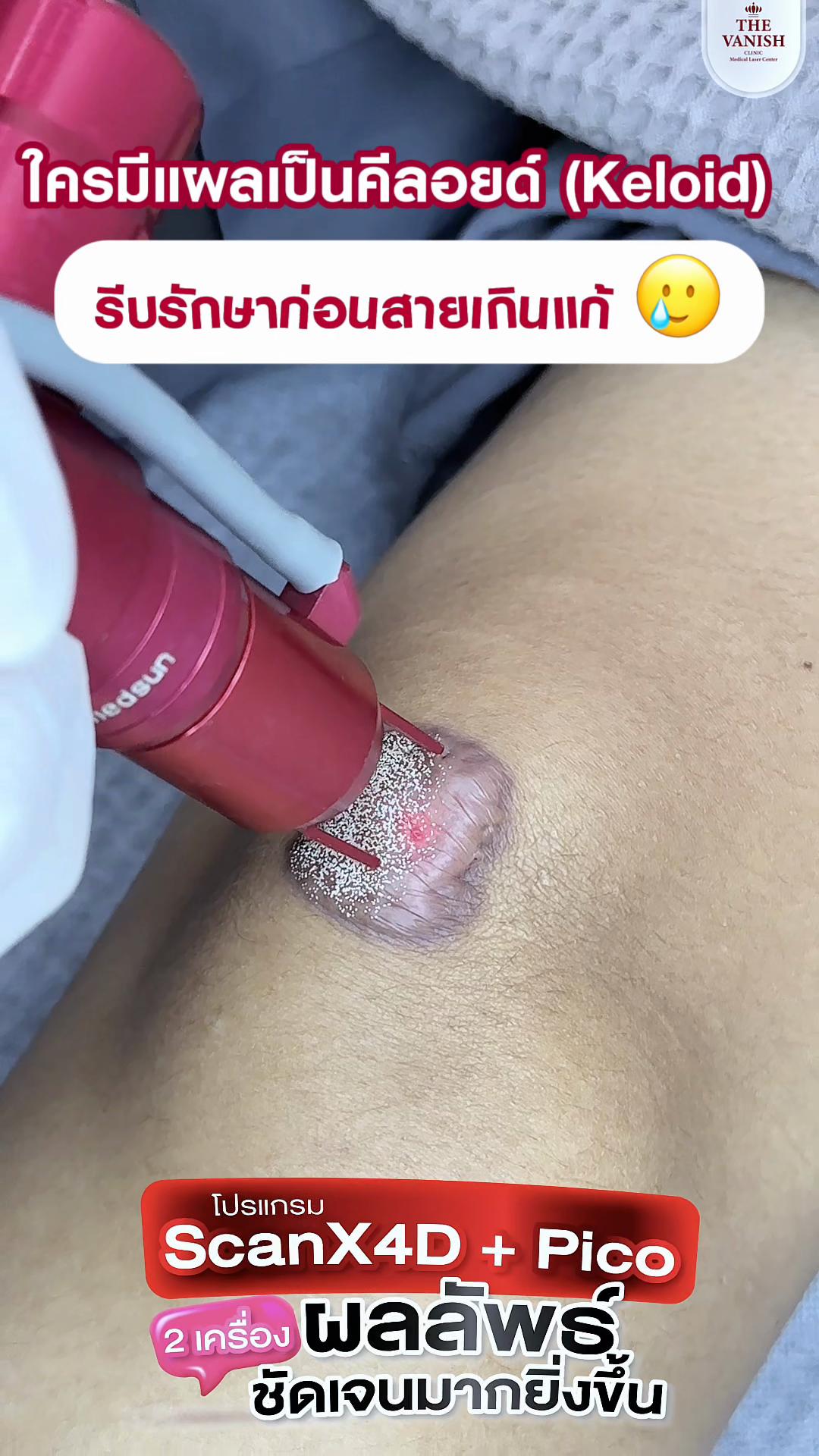 @The vanish clinic