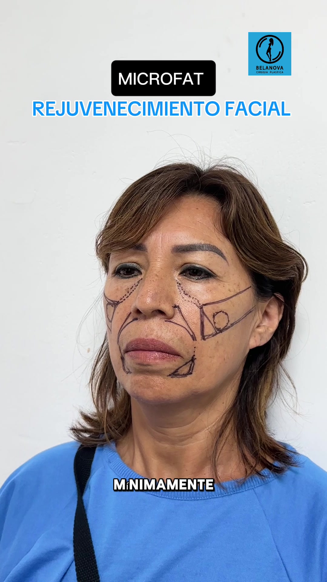 @Belanovacirugiaplastica