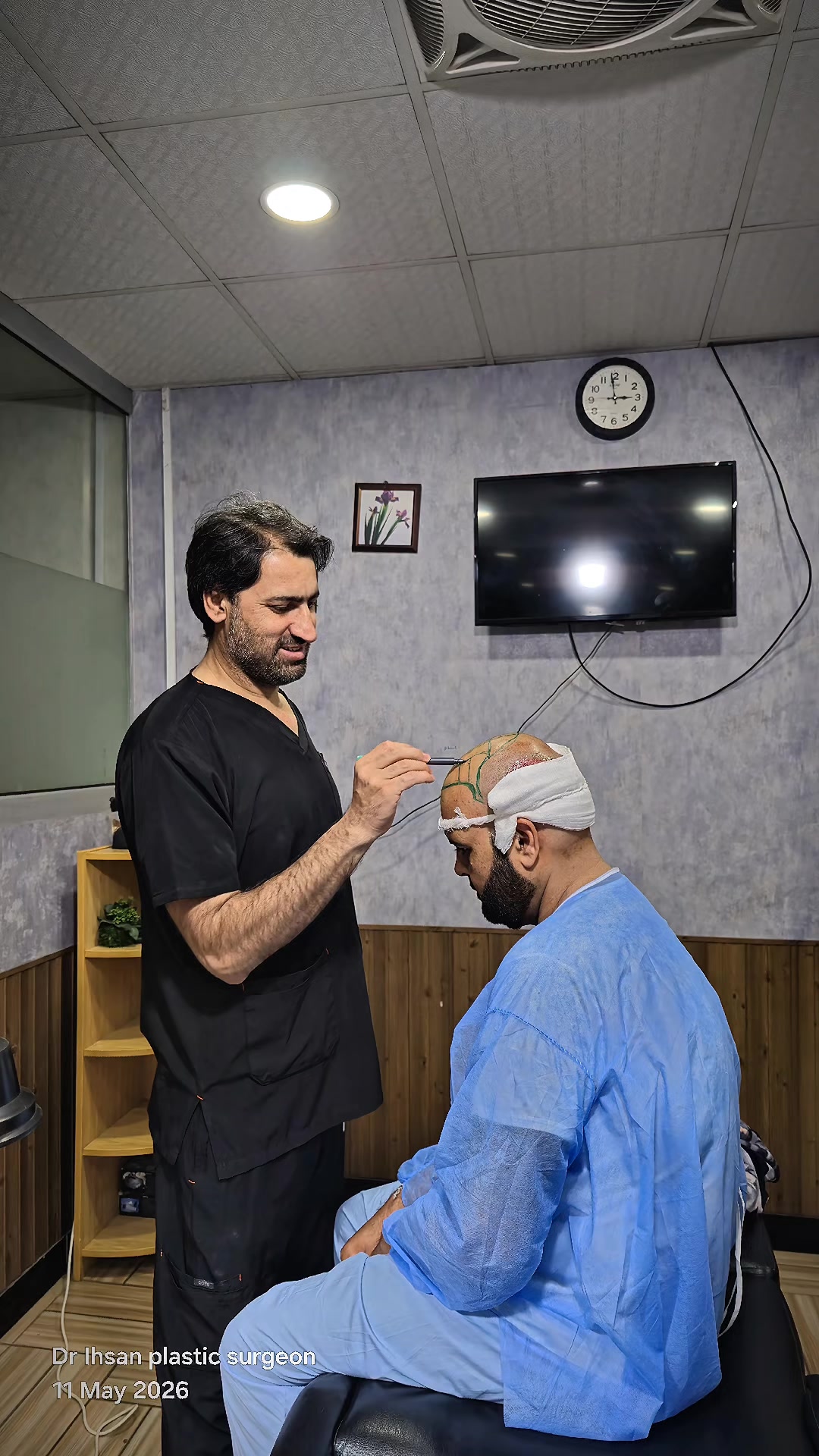 @Dr Ihsan Hair Transplant