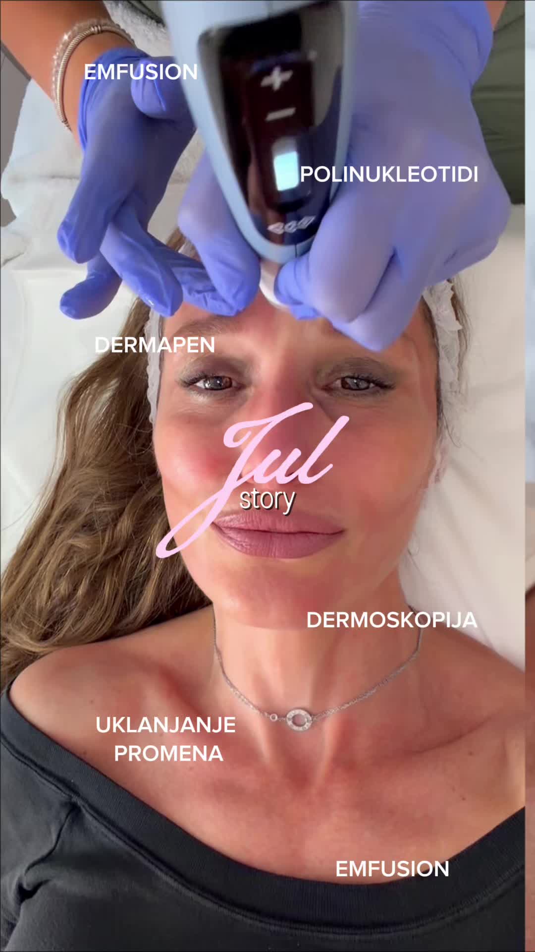 @DivaLaserCentar