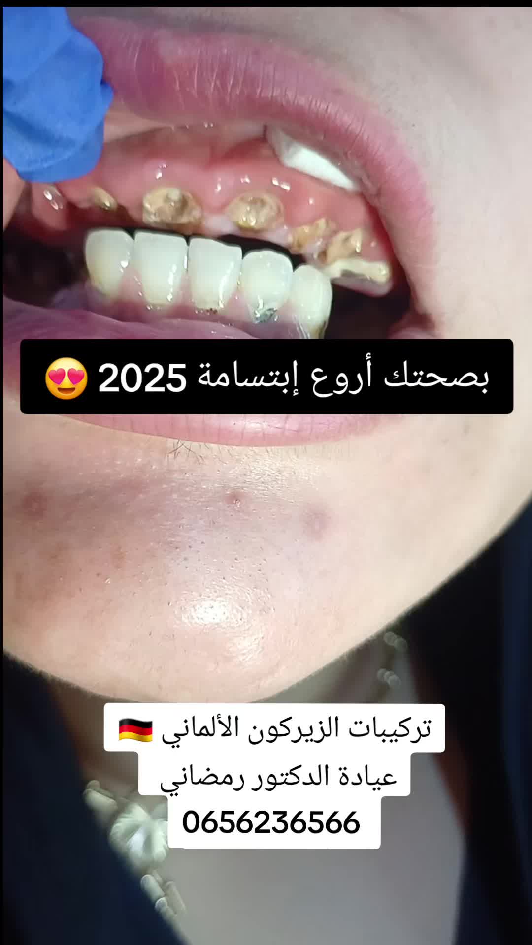 @Dr Ramdani Rassim
