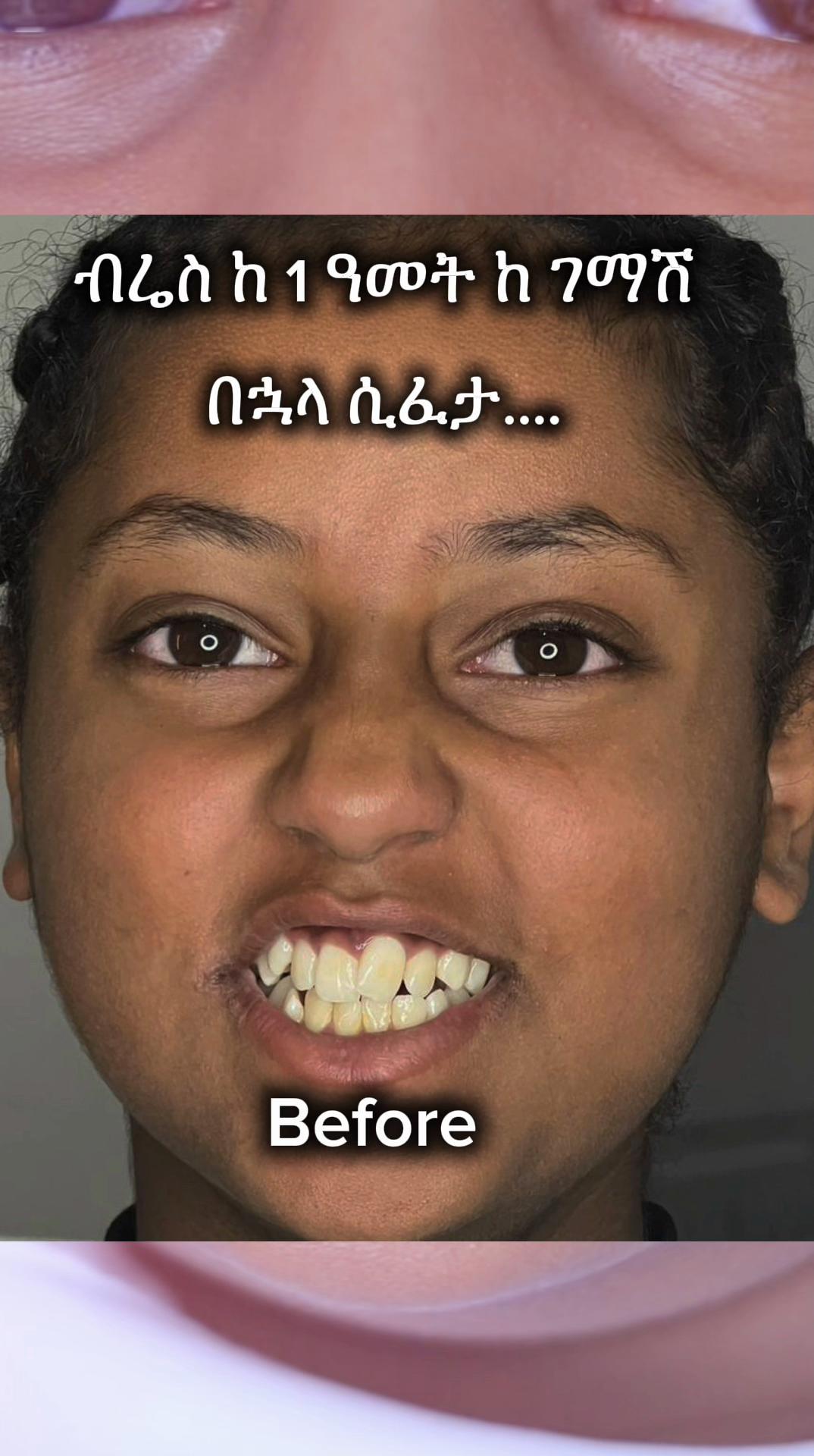 @drhelina_smile_architect