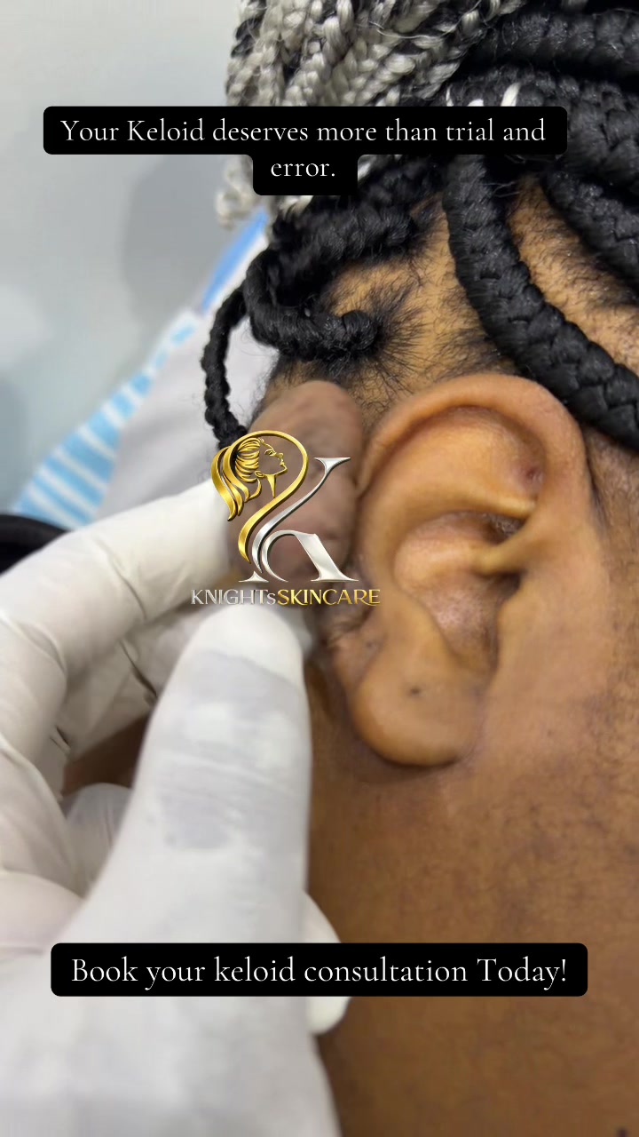 @KNIGHTS | SKINCARE | KENYA