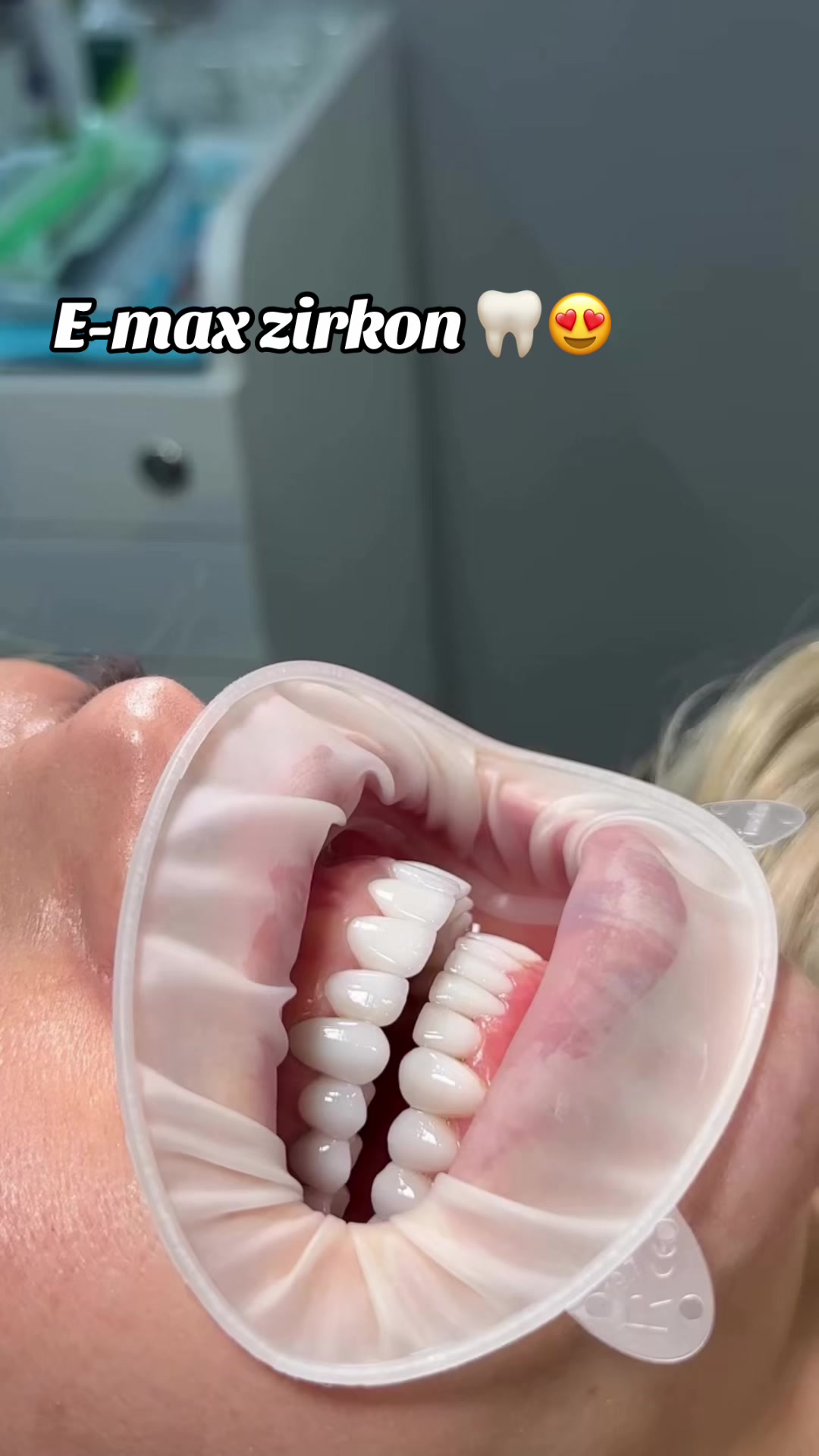 @𝐁𝐚𝐲𝐃𝐞𝐧𝐭𝐄𝐥𝐢𝐭𝐞 🦷