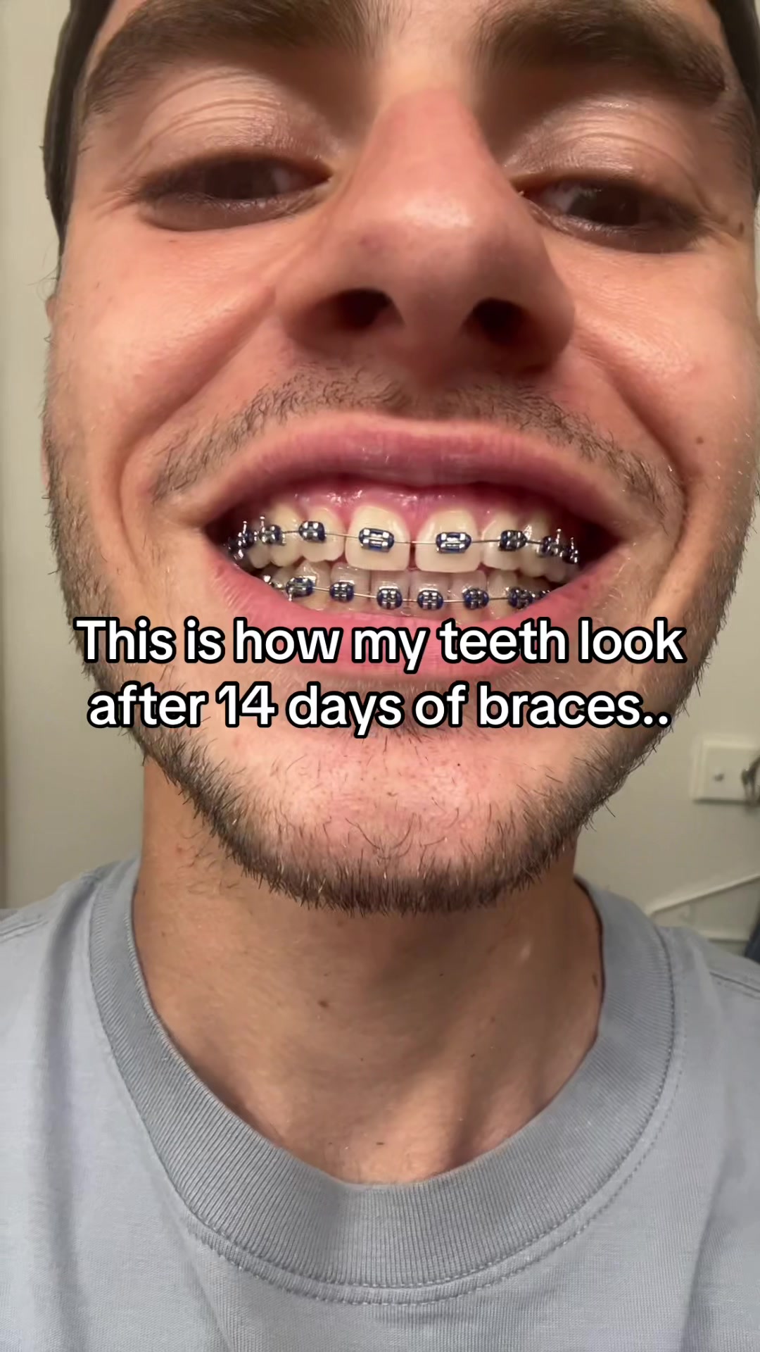 @mysmilejourney
