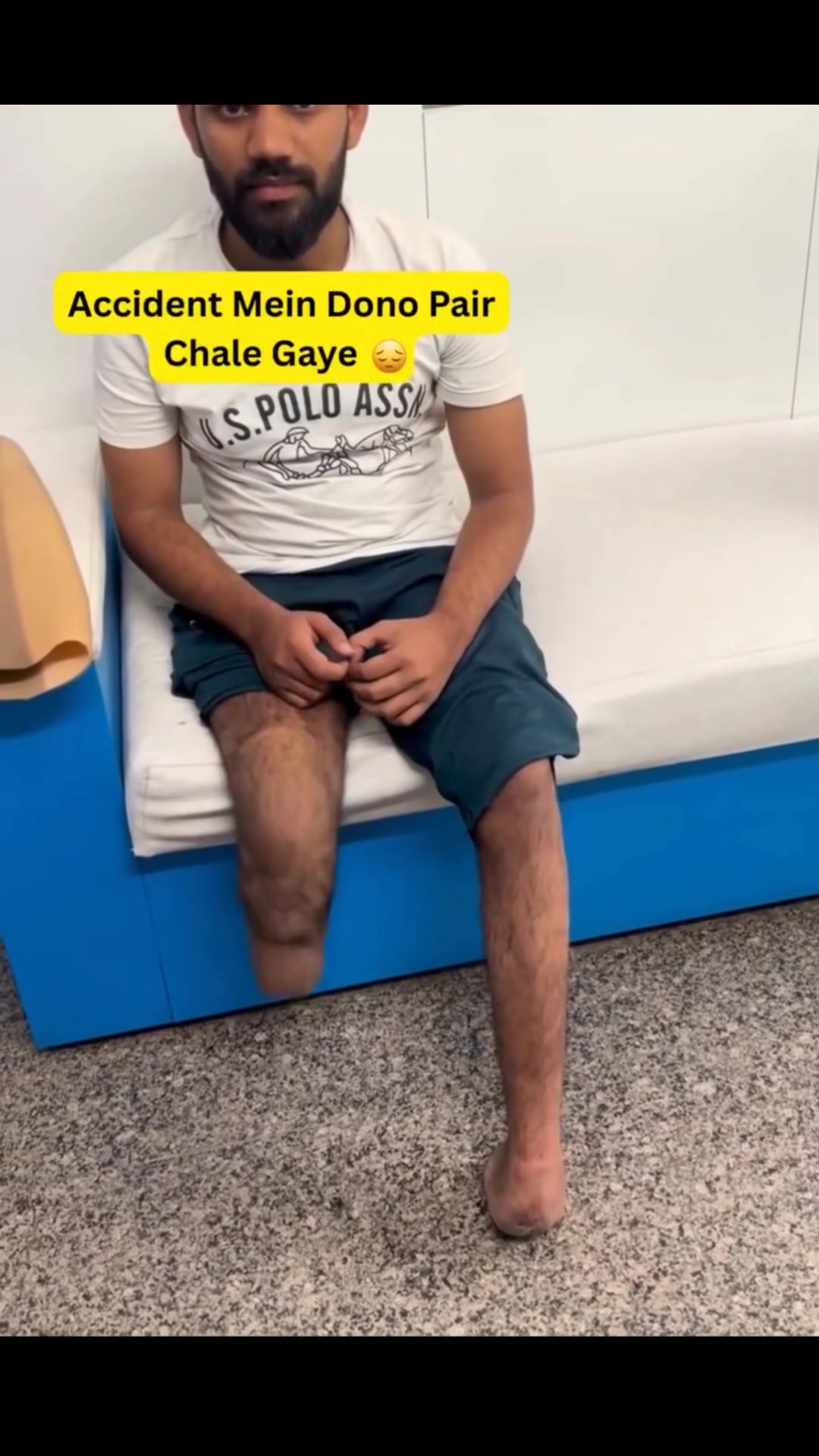 @مصنوعی اعضاء