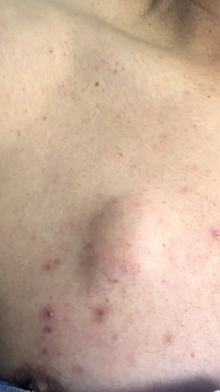 @dr.idrogodermatologo
