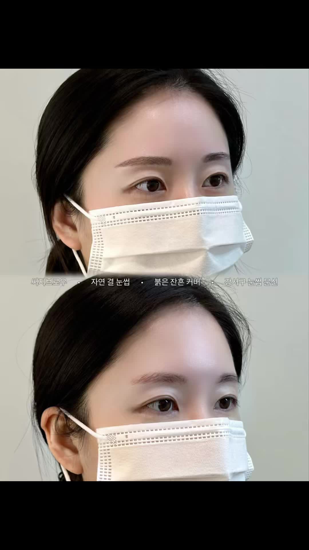@써지브로우 surgebrow