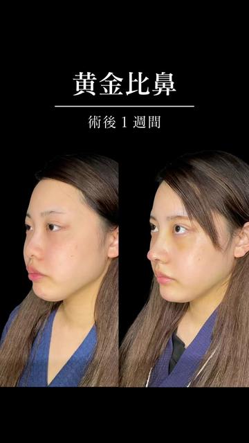 @ソ院長(バウム美容外科/トータル整形)