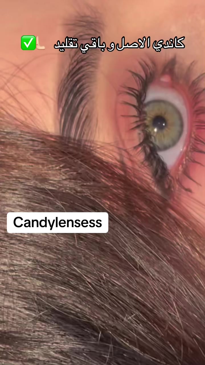 @Candy lensess