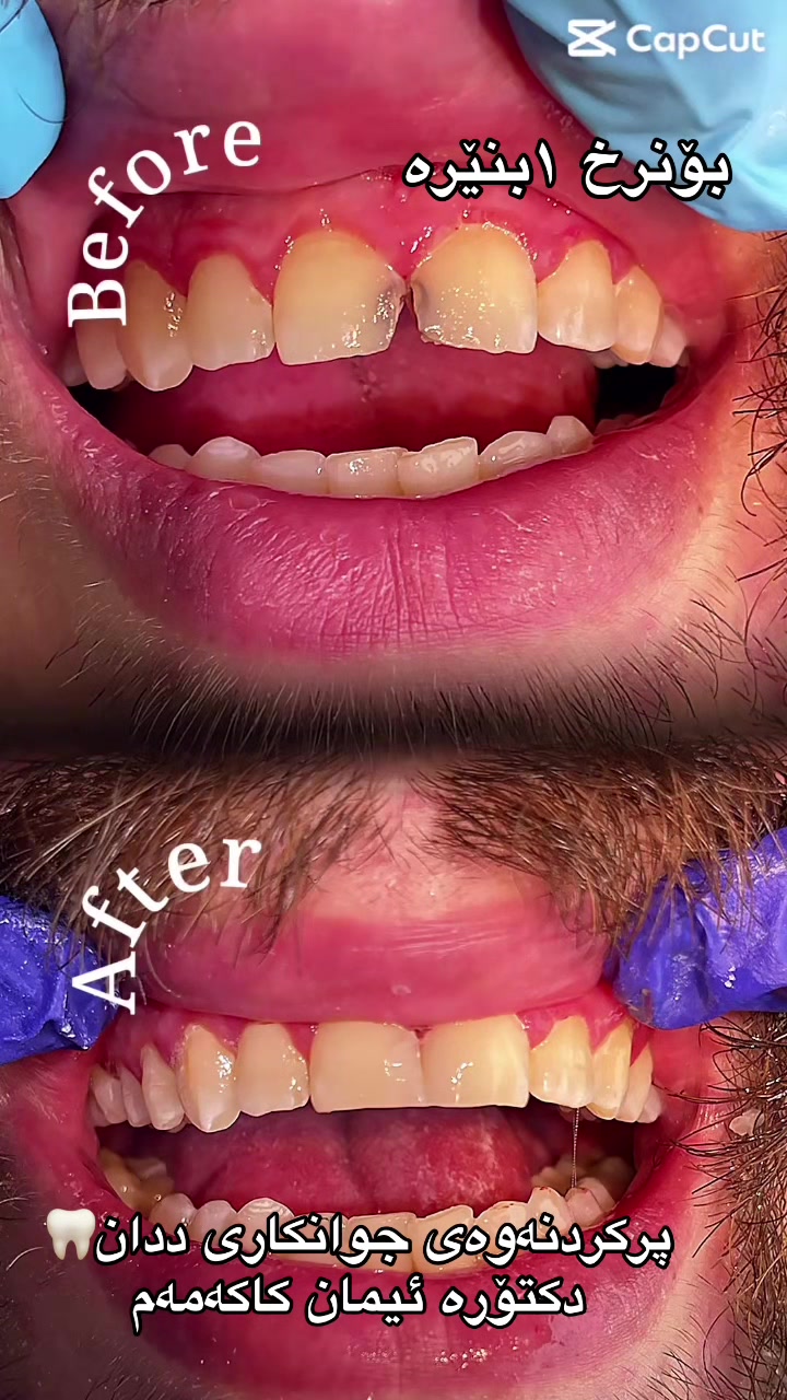 @🦷 دکتۆرە ئیمان کاکەمەم
