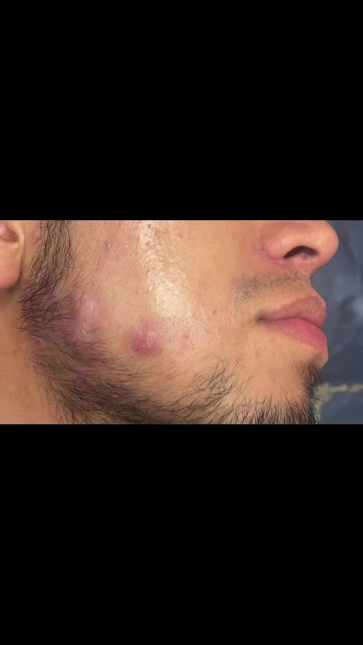 @Dra Silvia Lorena FLORES derma