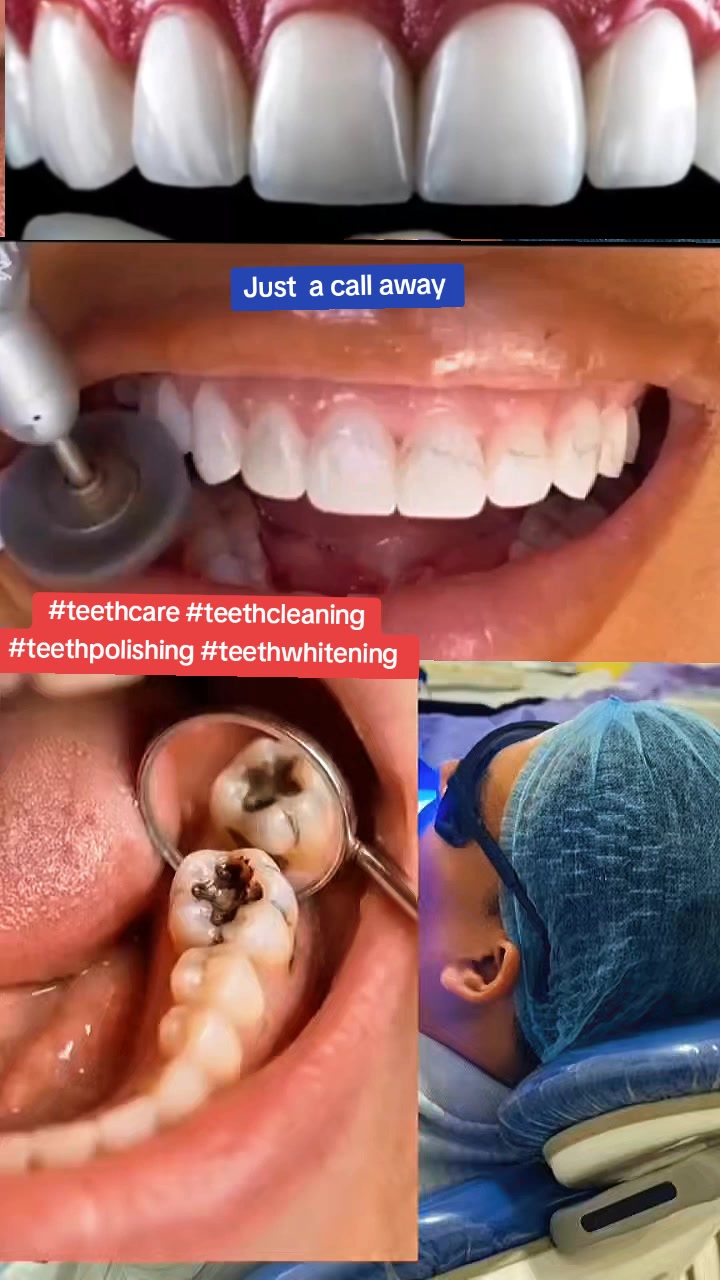 @Allianz Dental studio🦷🦷🇺🇬