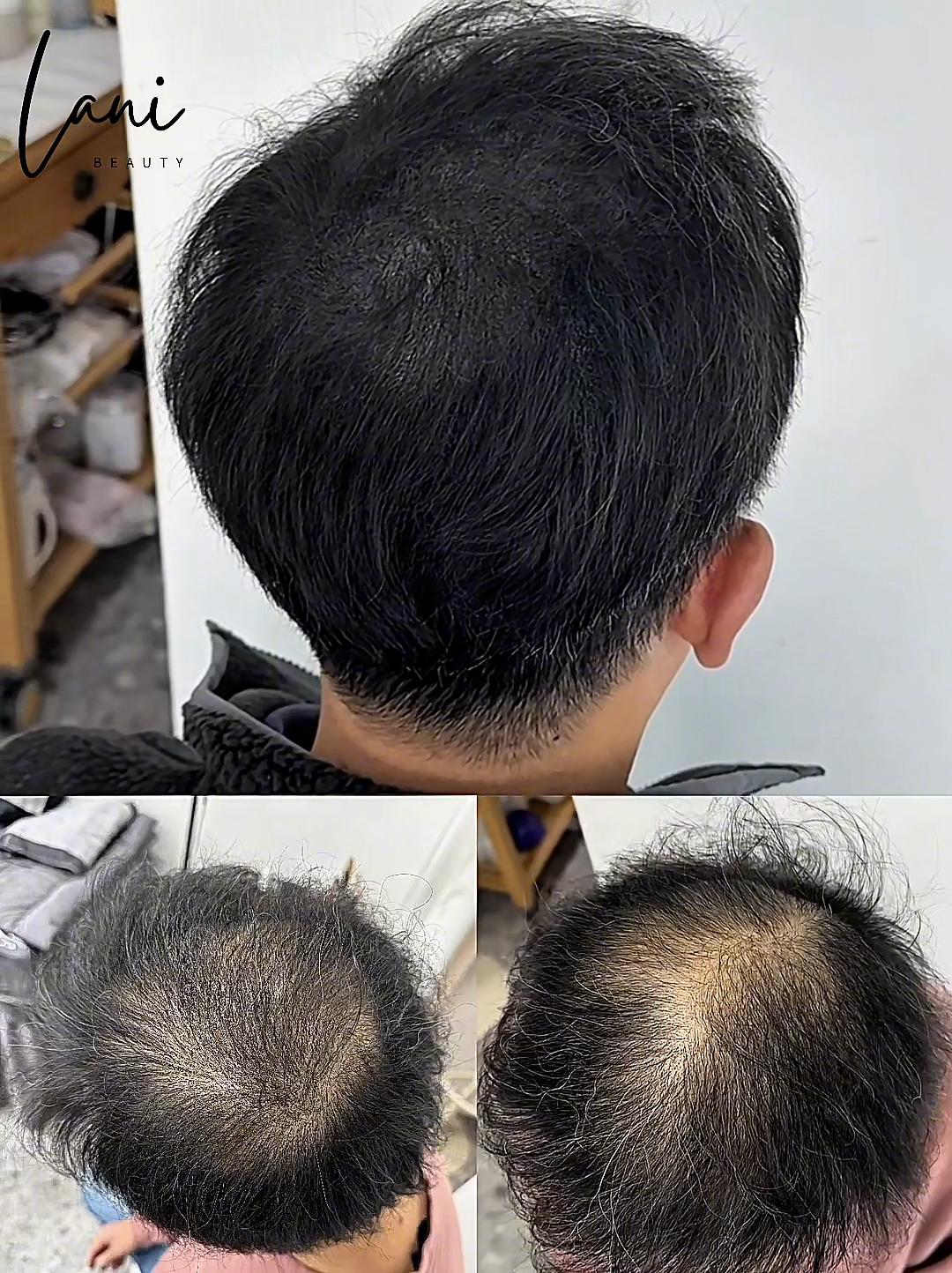 @일산눈썹문신 일산반영구수강 라니뷰티