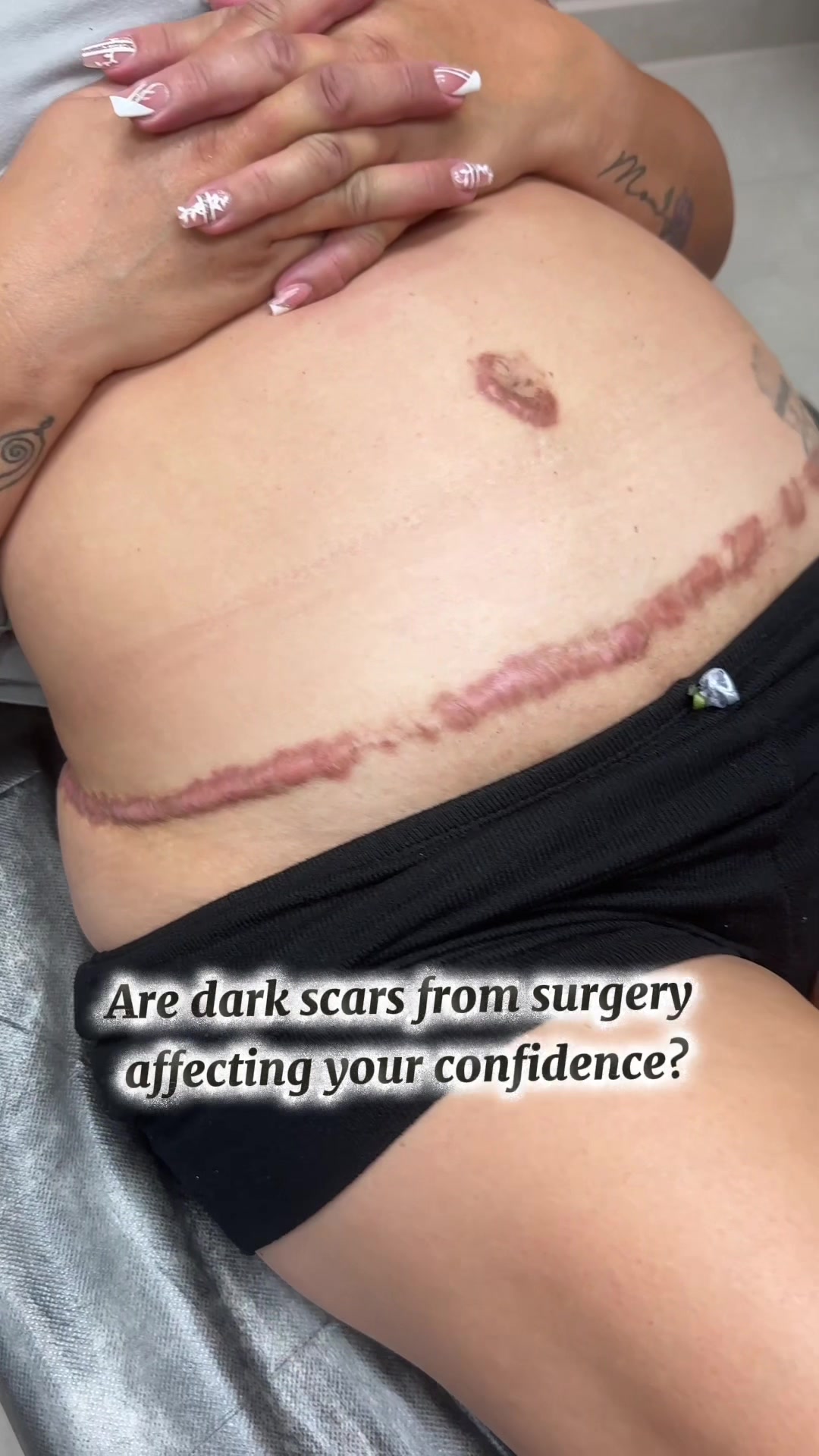 @Invisibleskinhelp