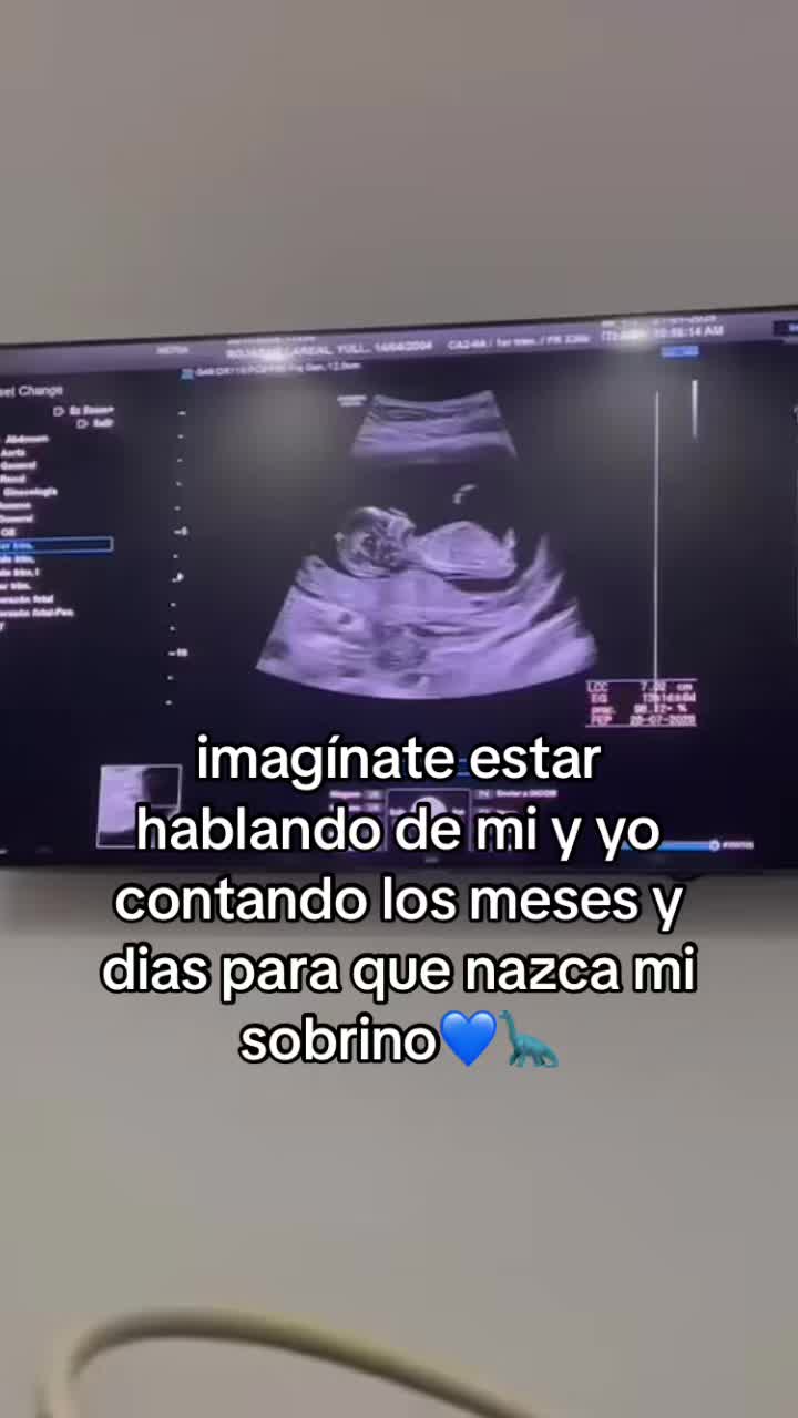 @Carolay Centeno