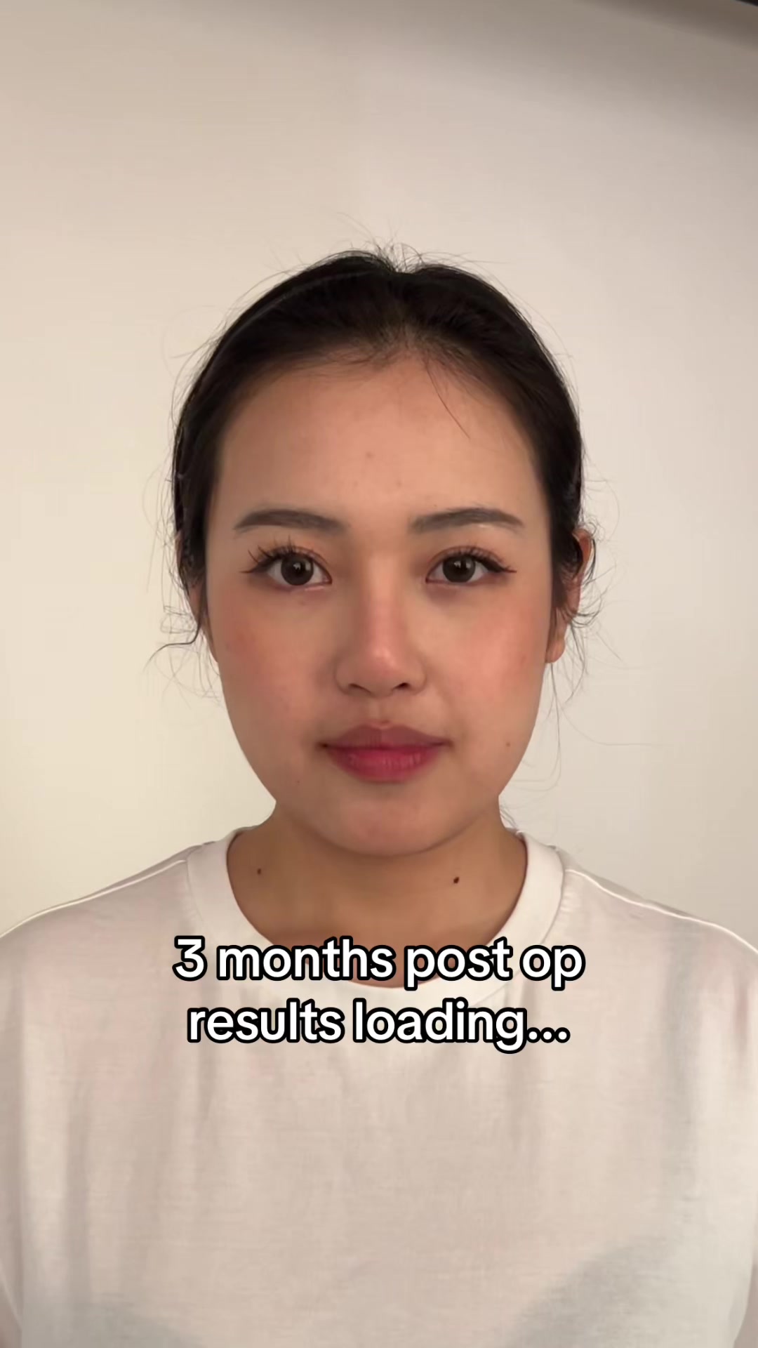 @braun