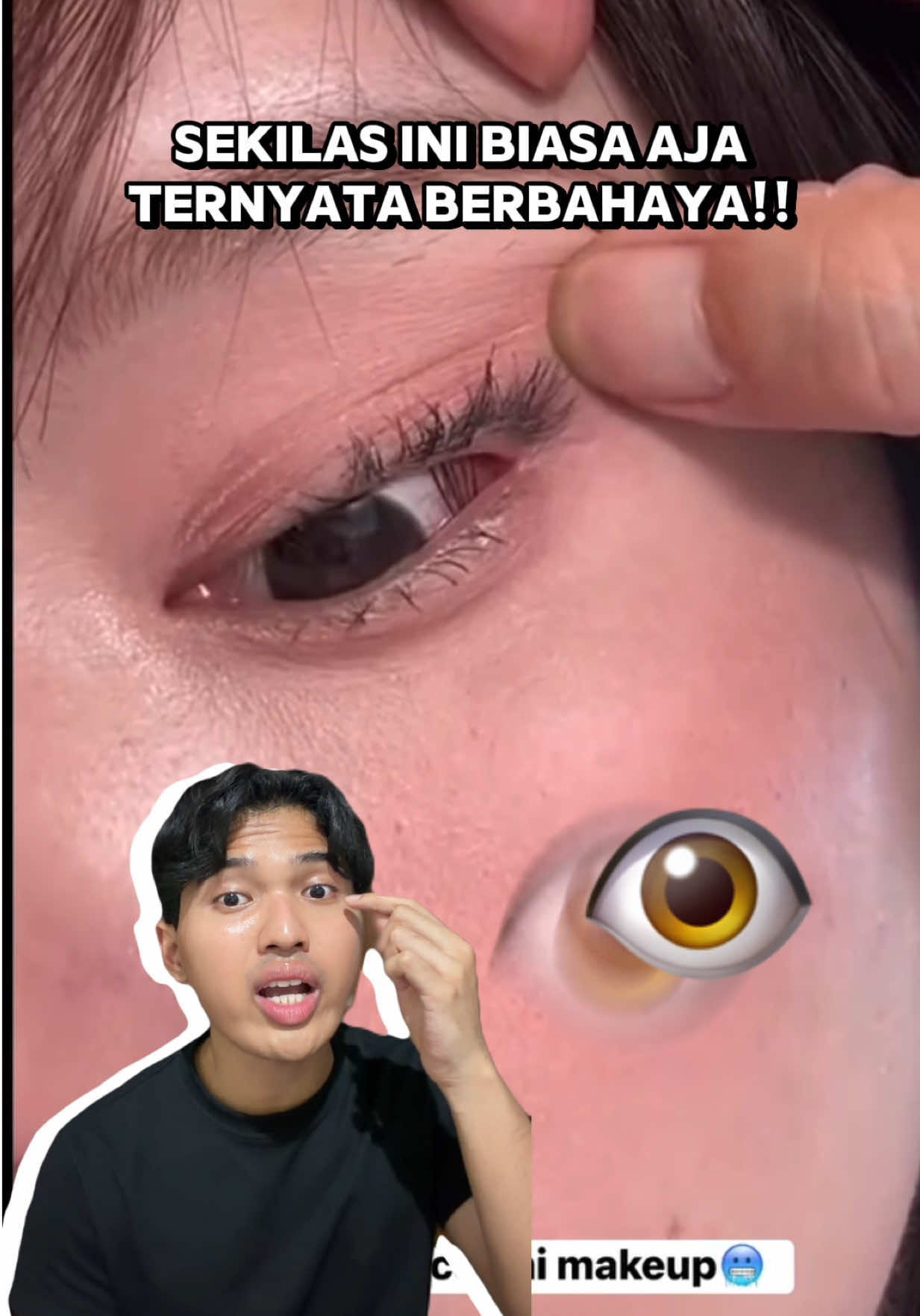 @Ekida