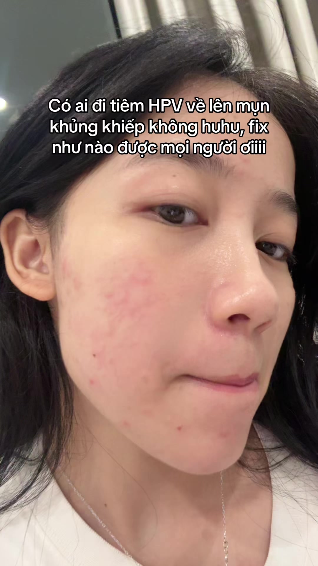 @chưa mối tình đầu
