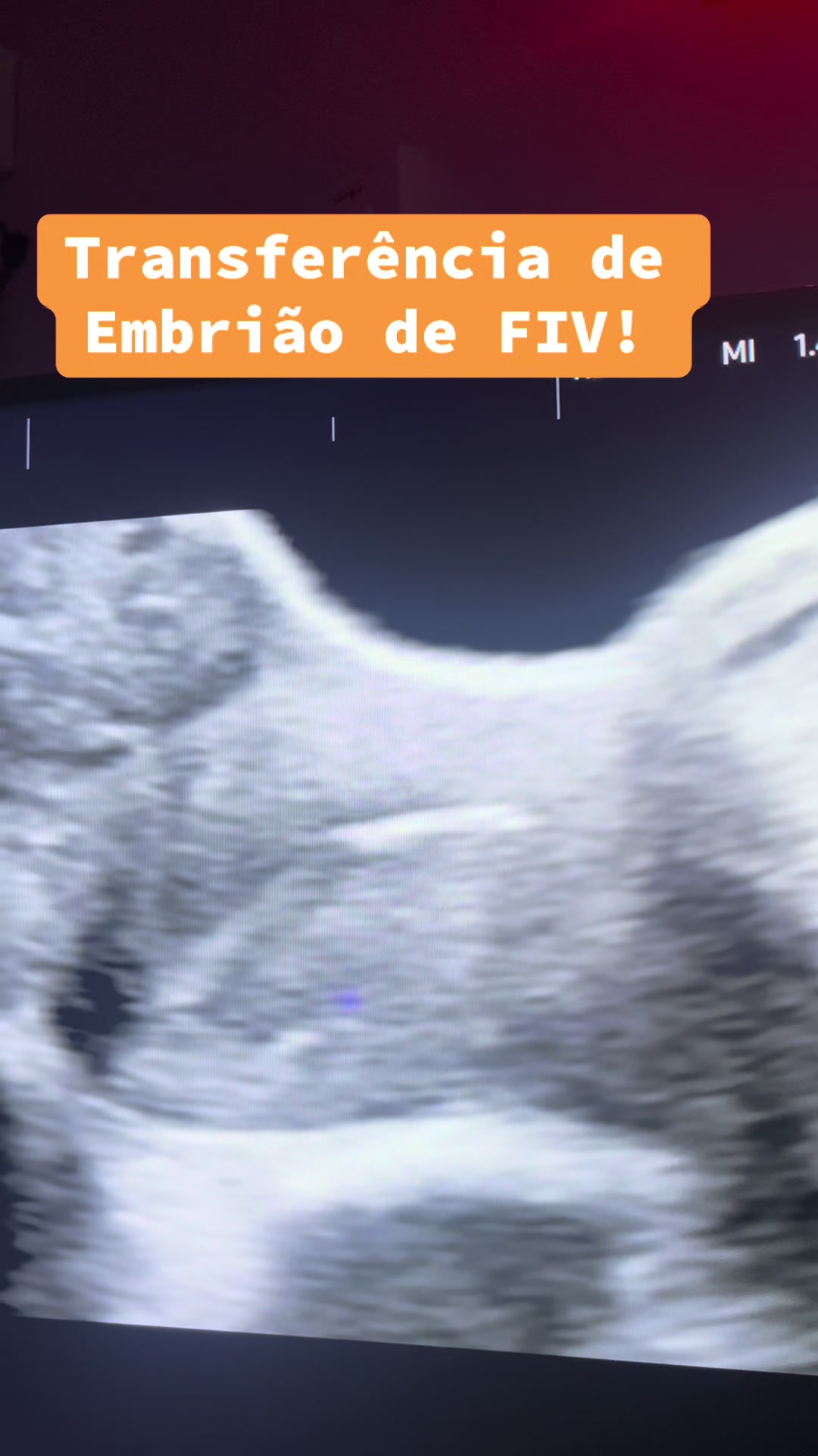 @Dr.ivanpenna