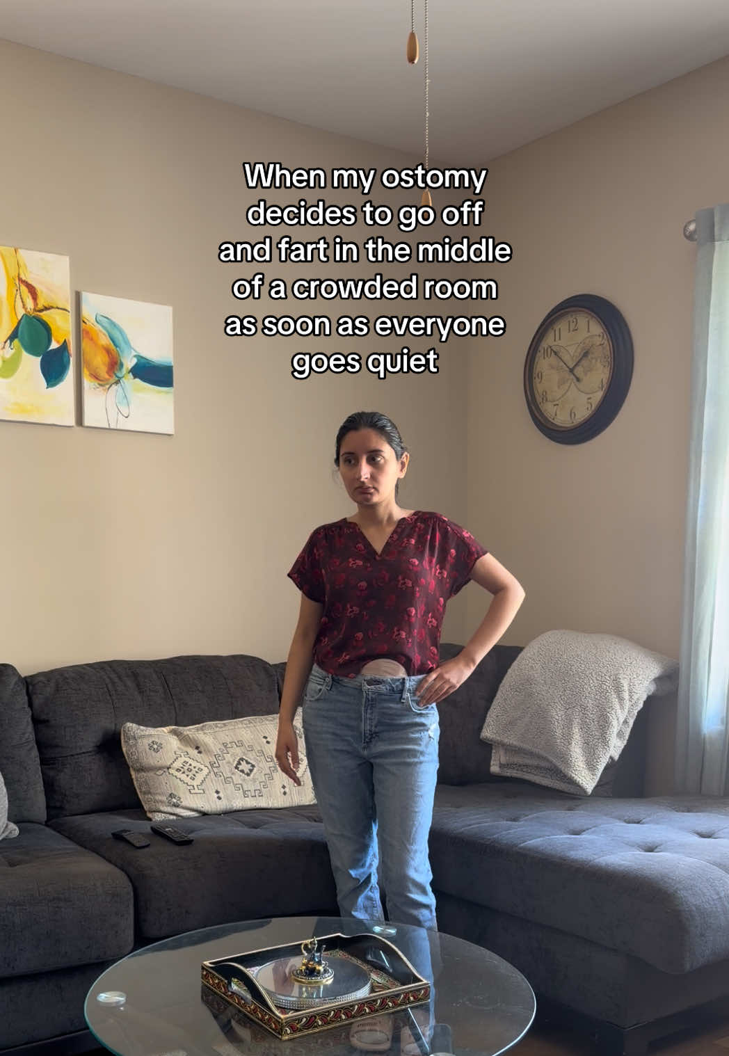@ostomate
