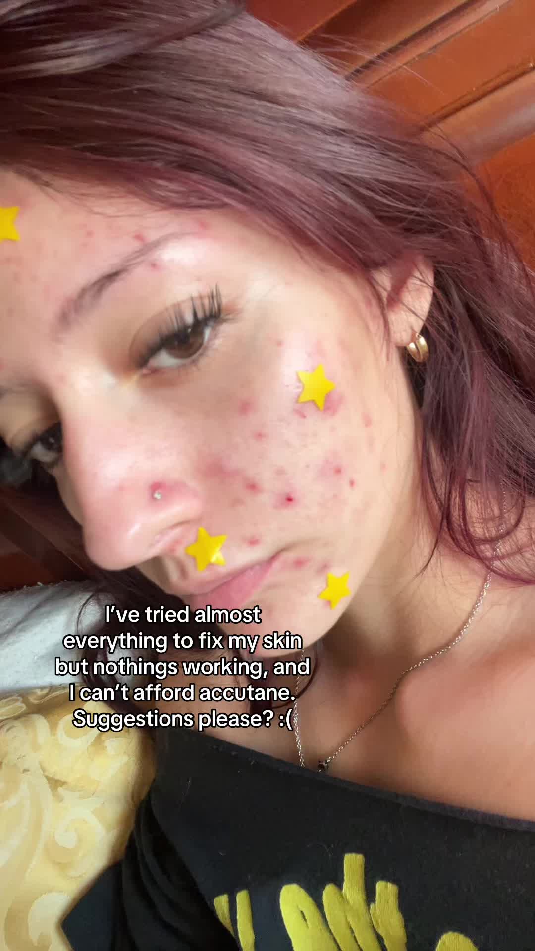 @:)