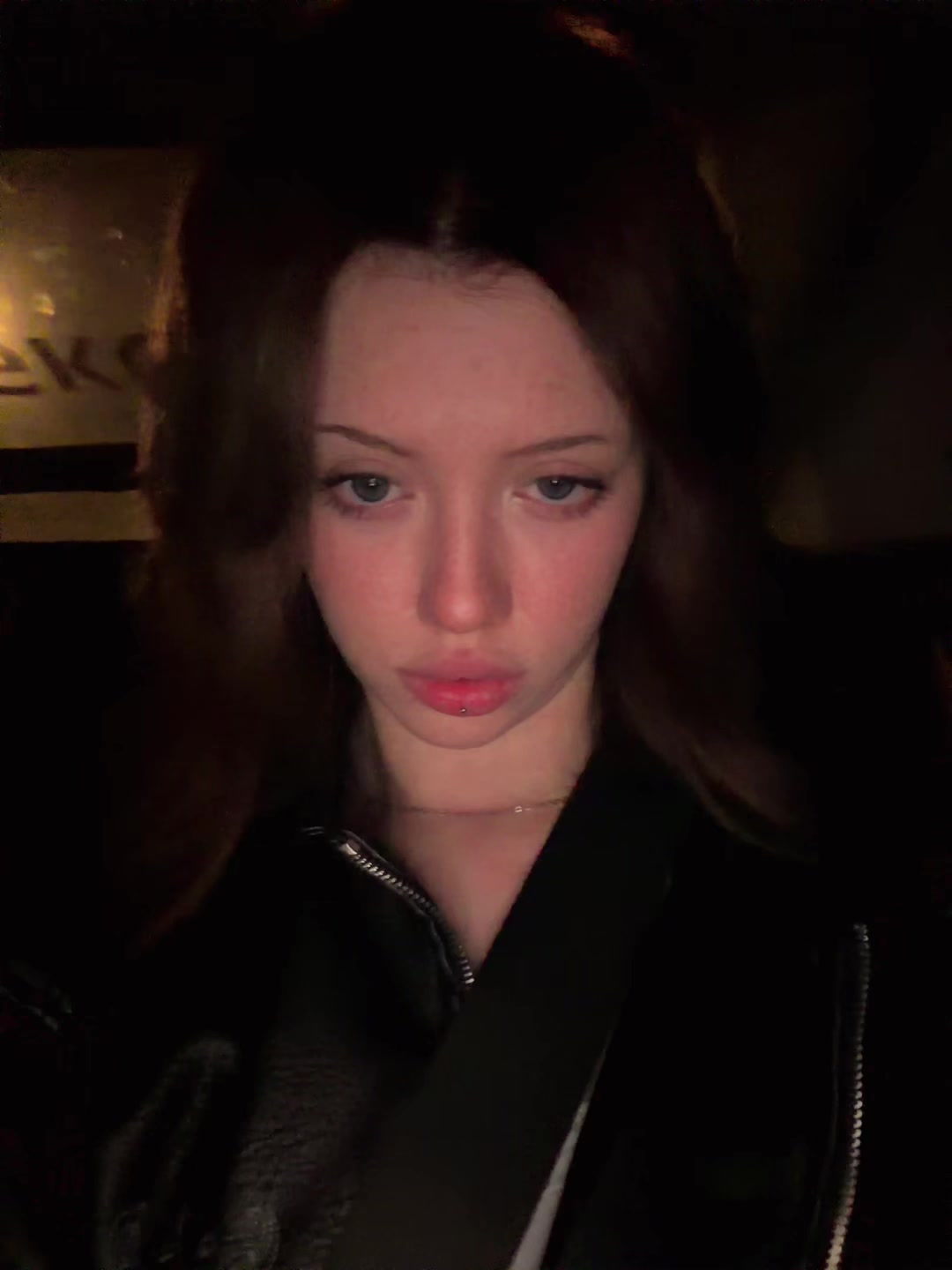 @глаукома