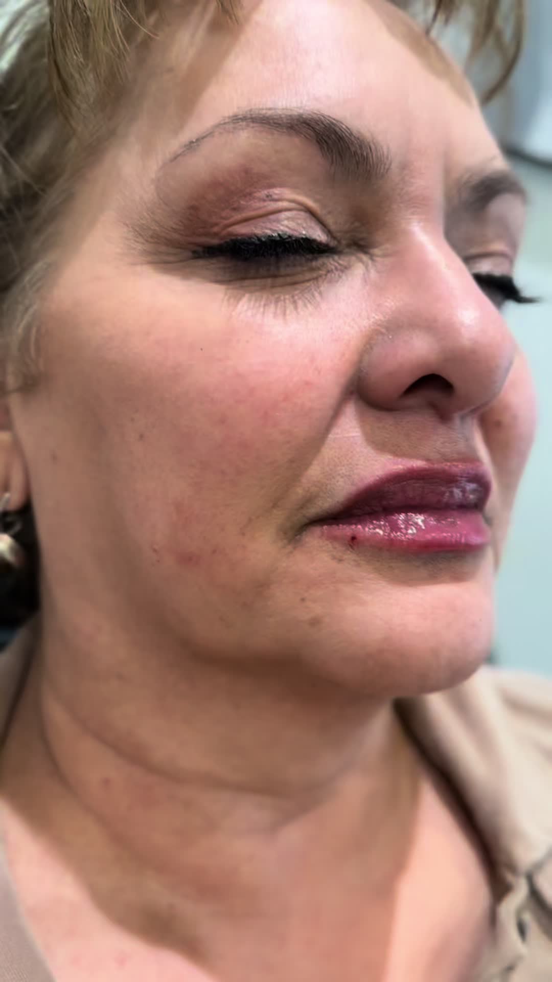 @tox.nurse.j