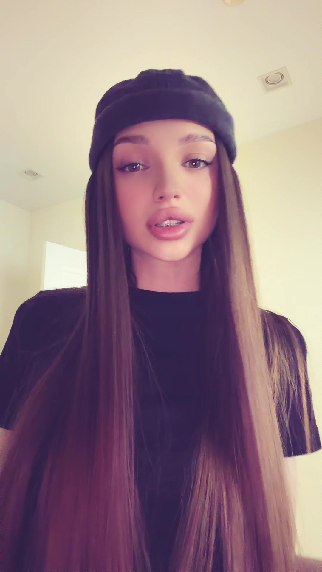 @Vi🤍