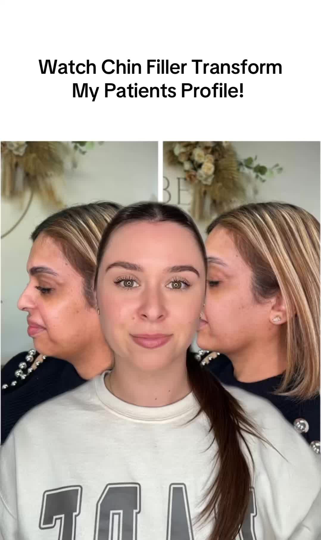 @injectoraleenp