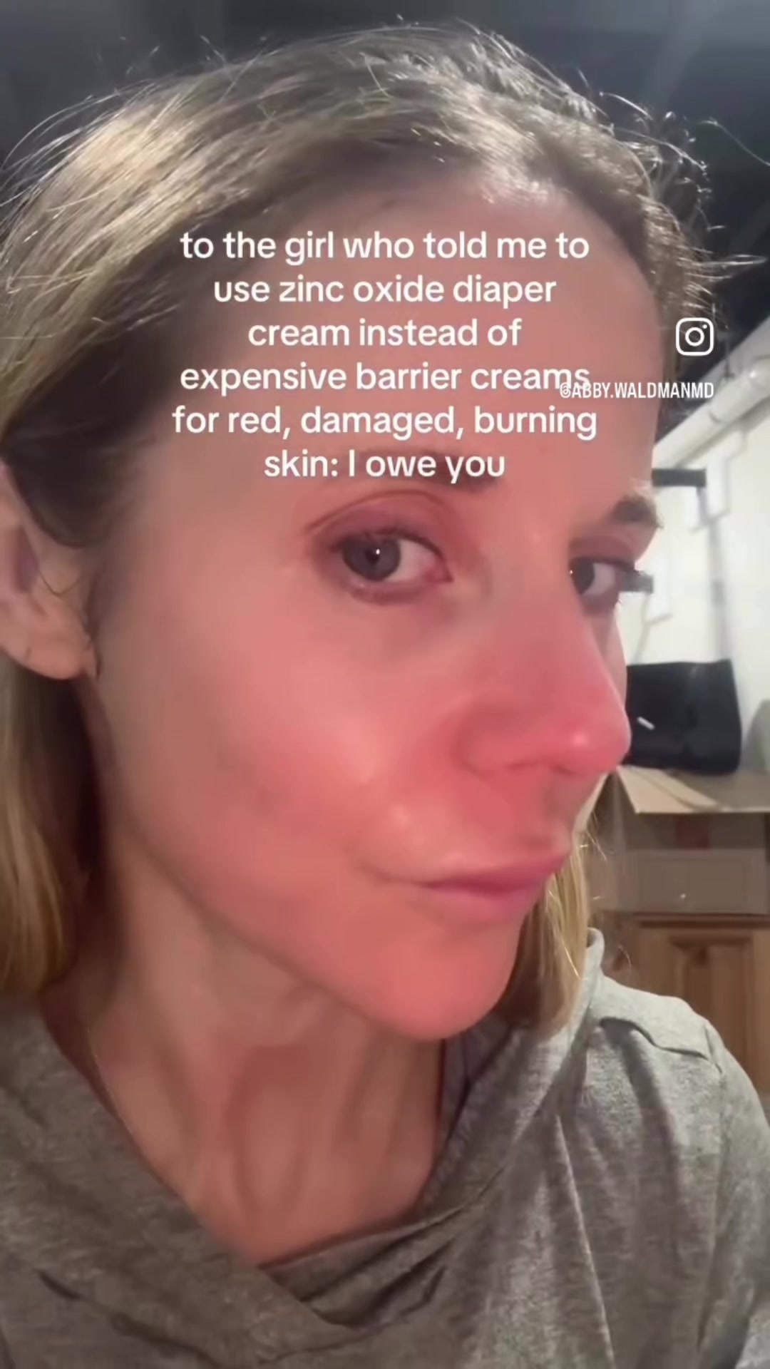 @Pure Skin OC