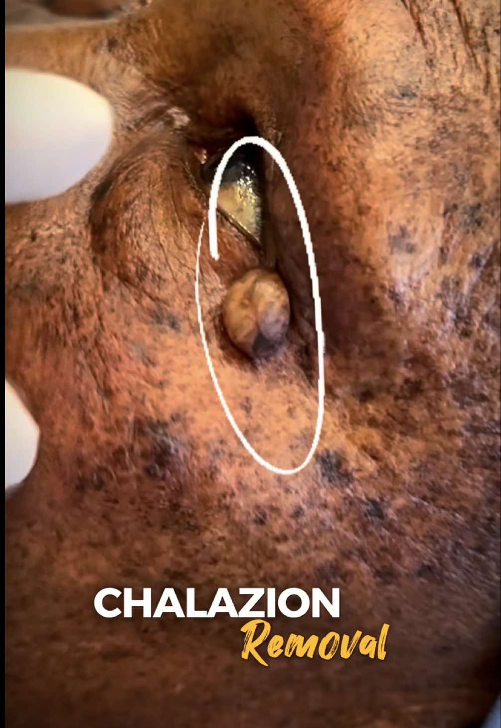 @Skin Dictionary