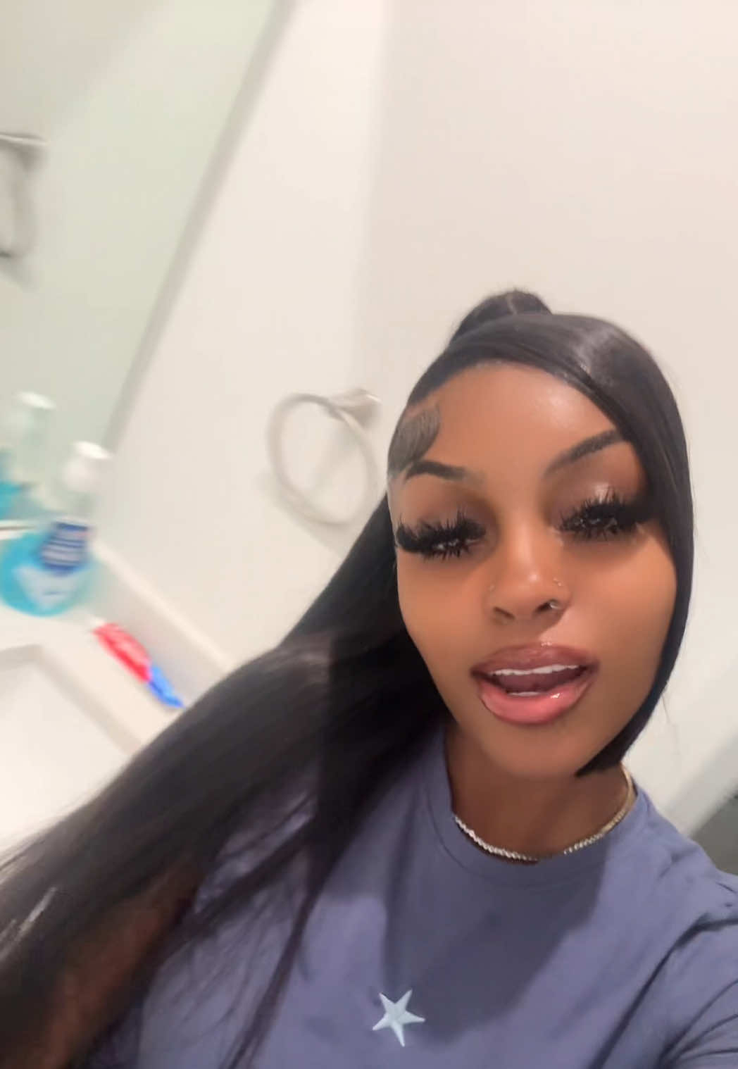 @rare.